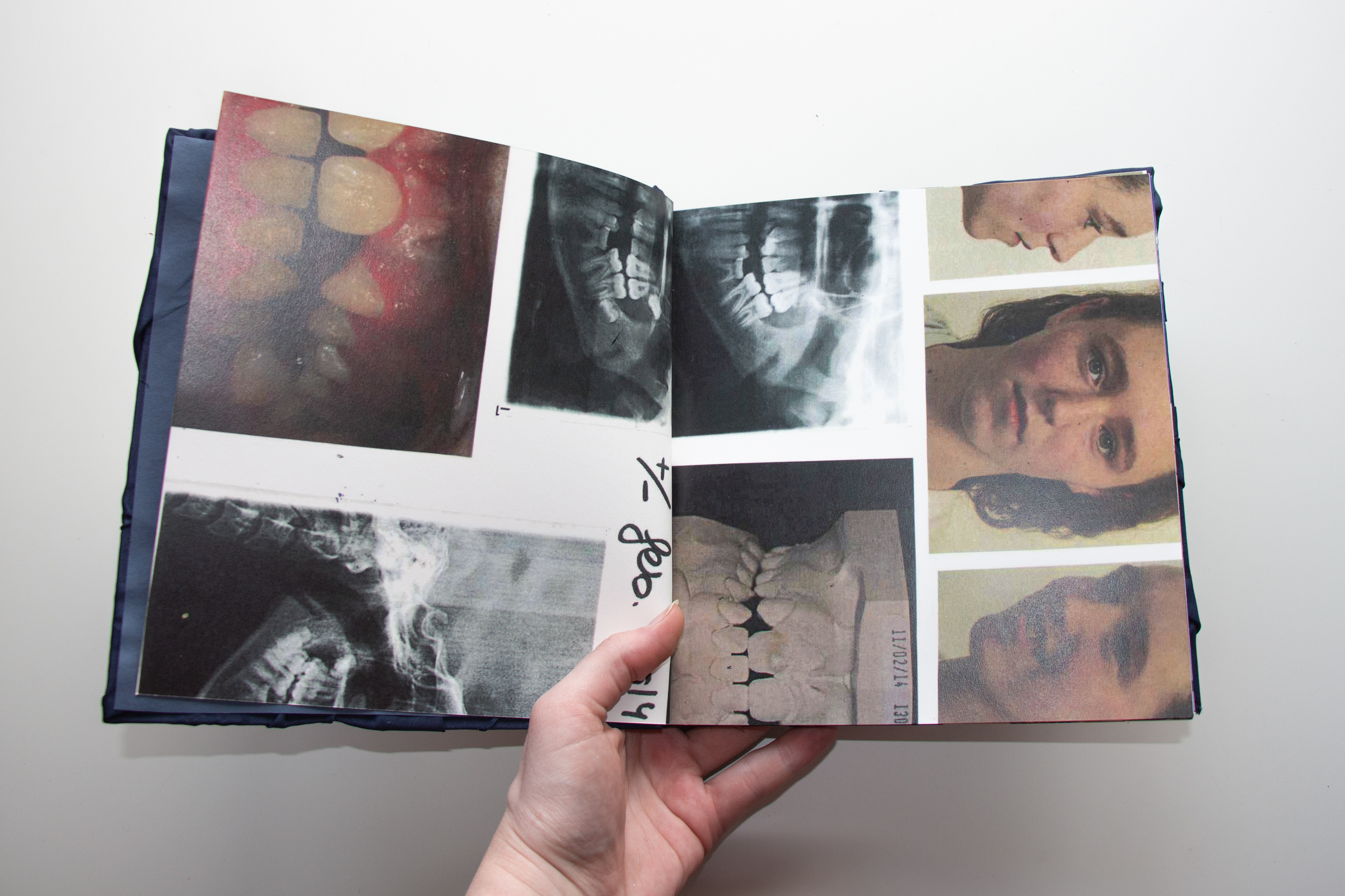 collection book
