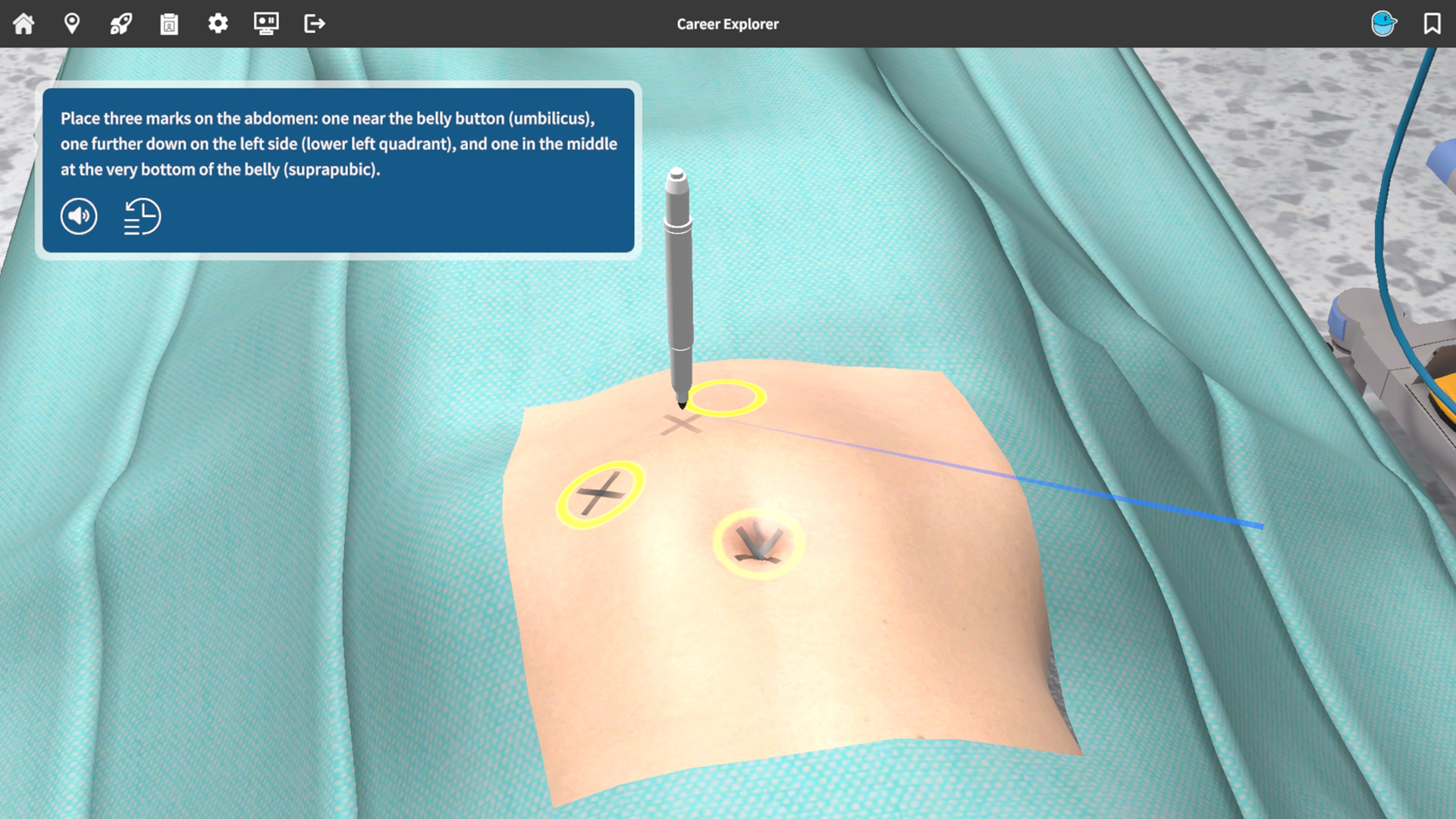 Appendectomy (Closeup)