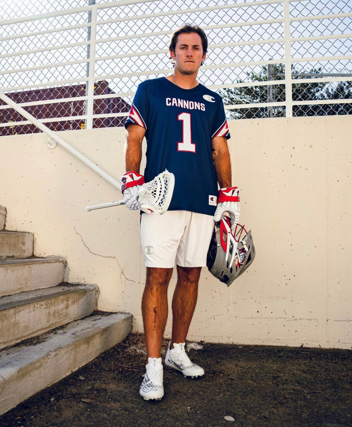 Full body with on field accessories