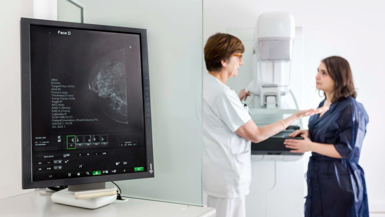 imagerie médicale mammographie