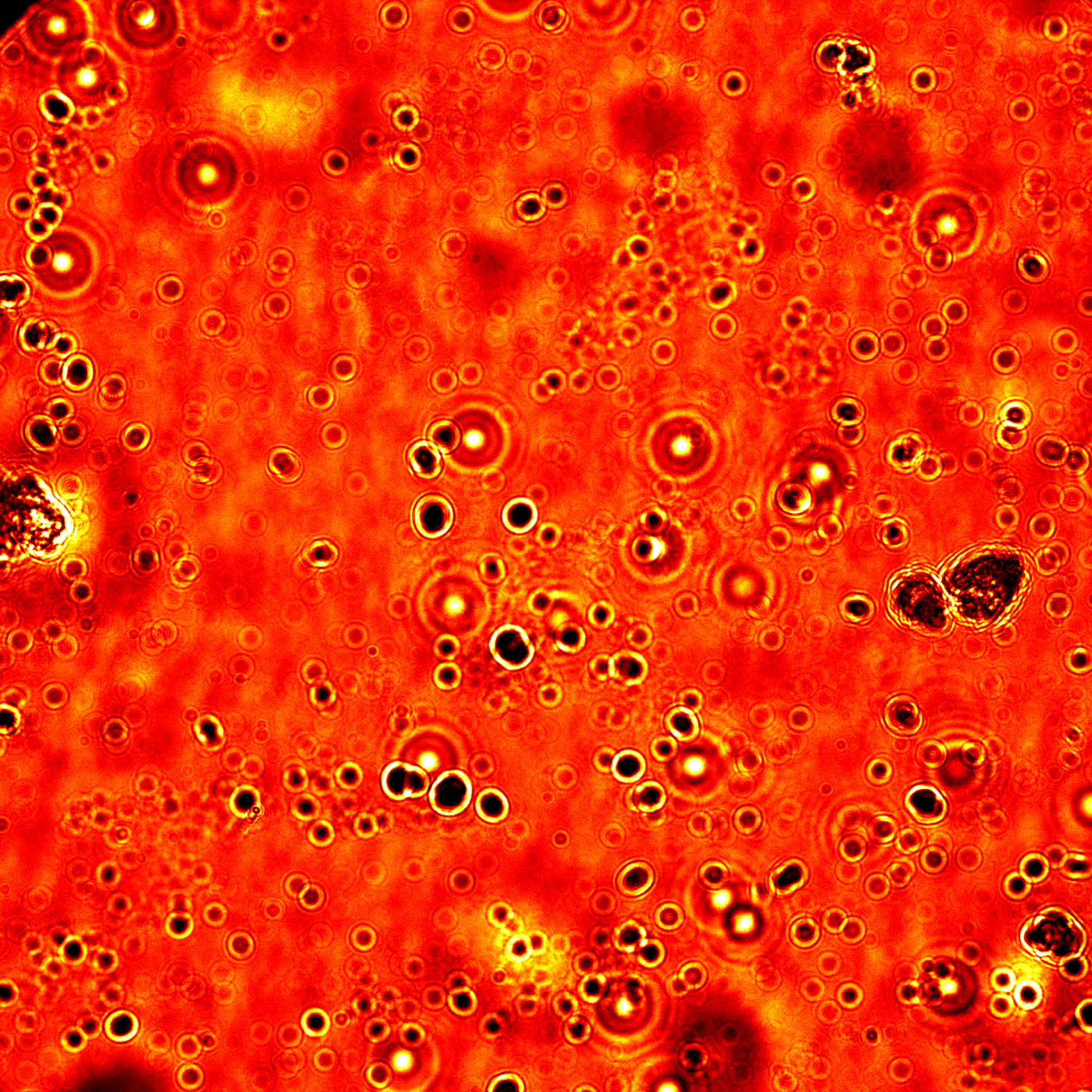 Drop of Blood (Bright-field Microscopy)