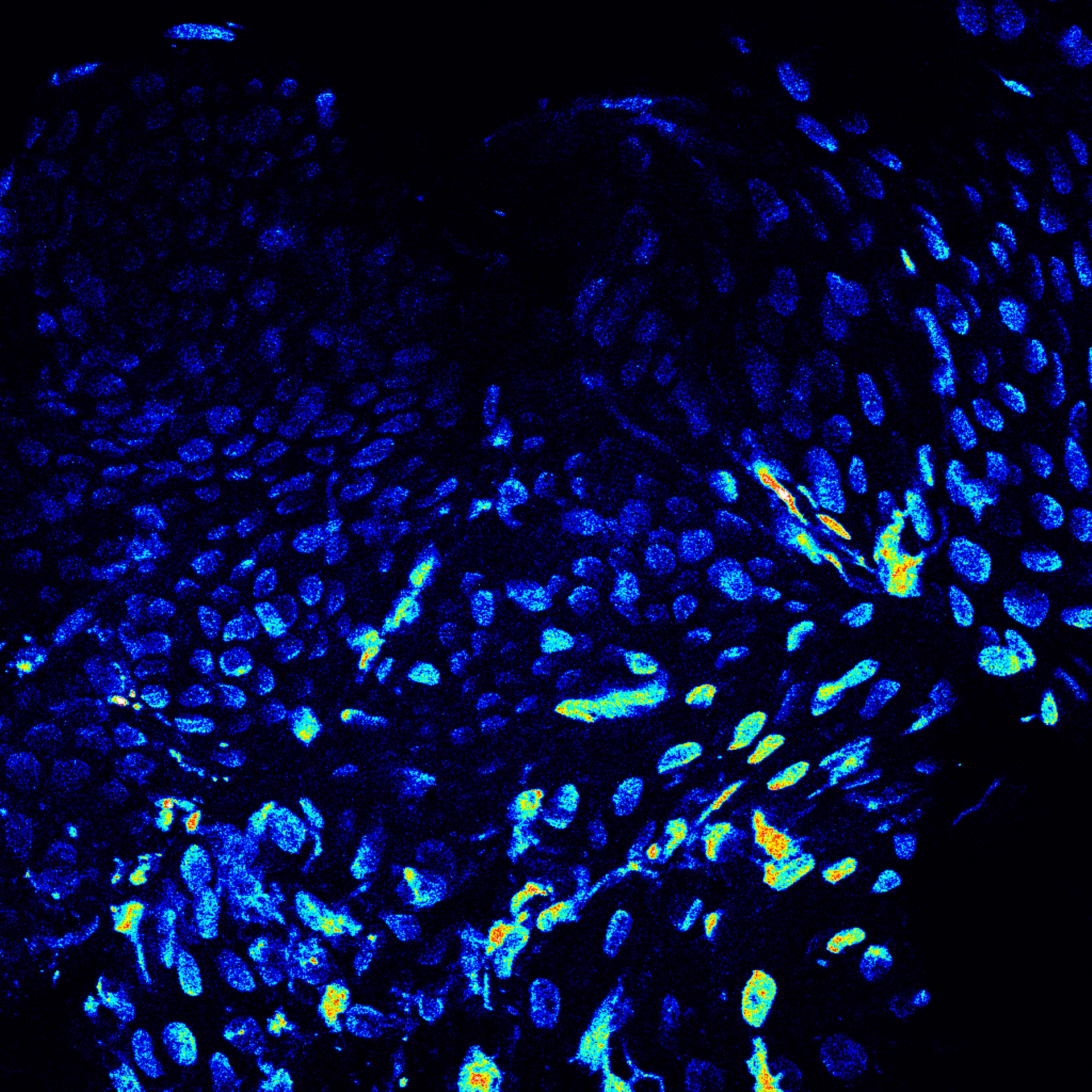 Live Skin Cells stained with Actin (Fluorescence Microscopy)