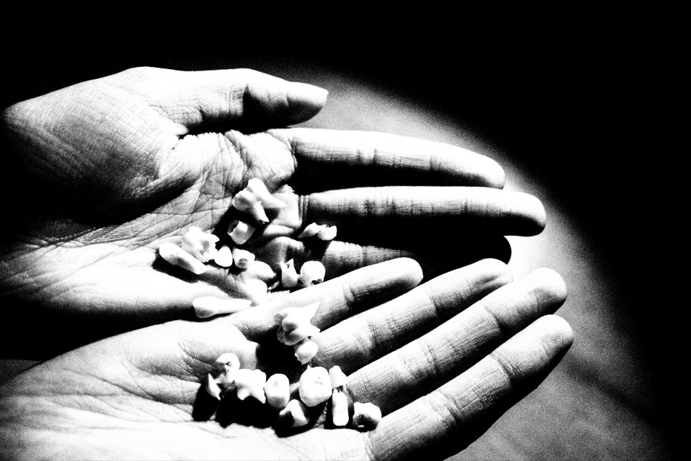 "Teeth Falling Out" - Looking down into your palms and realizing you've just lost all your teeth. © Elizabeth Frone