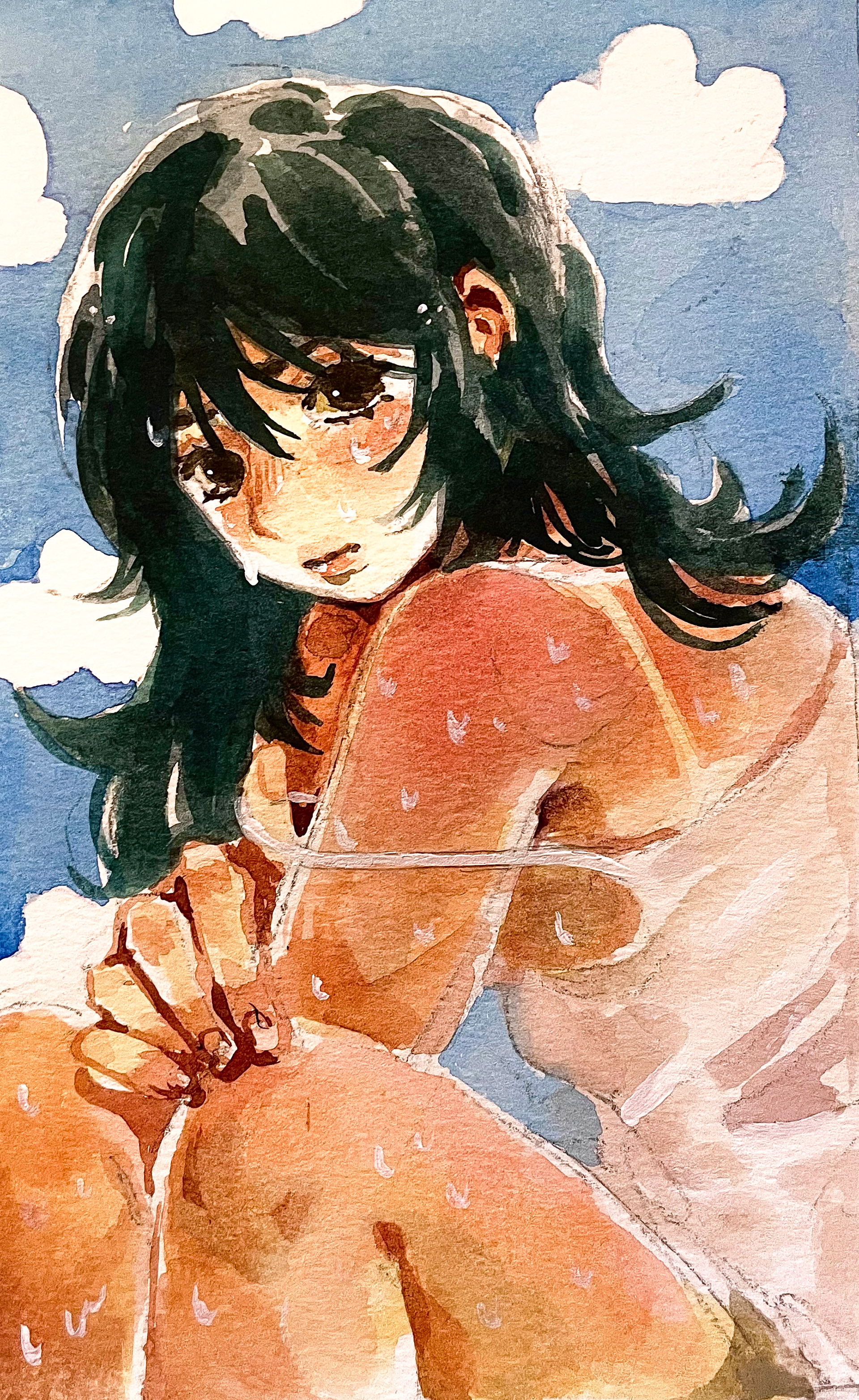 sunburn