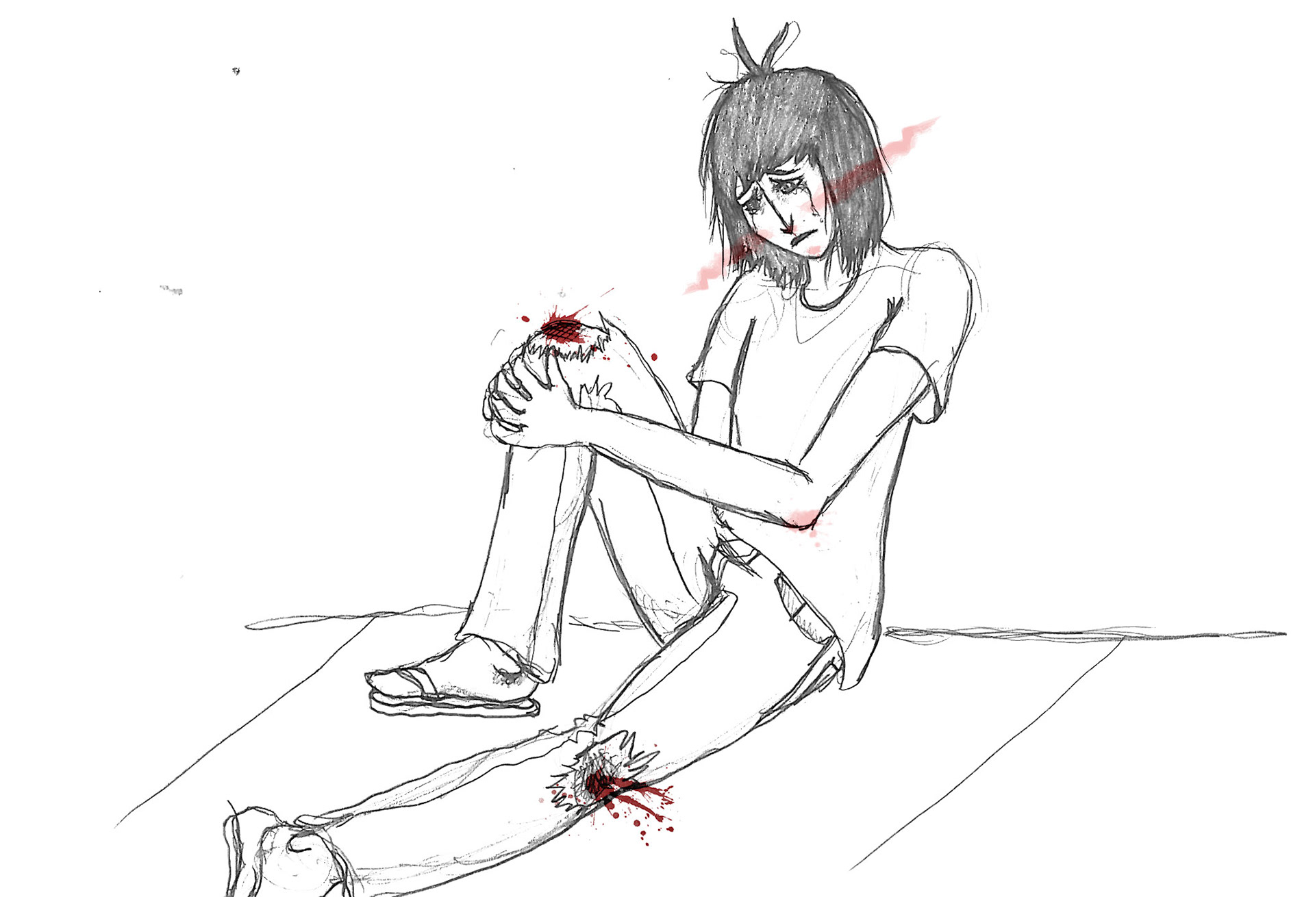 Abrasion