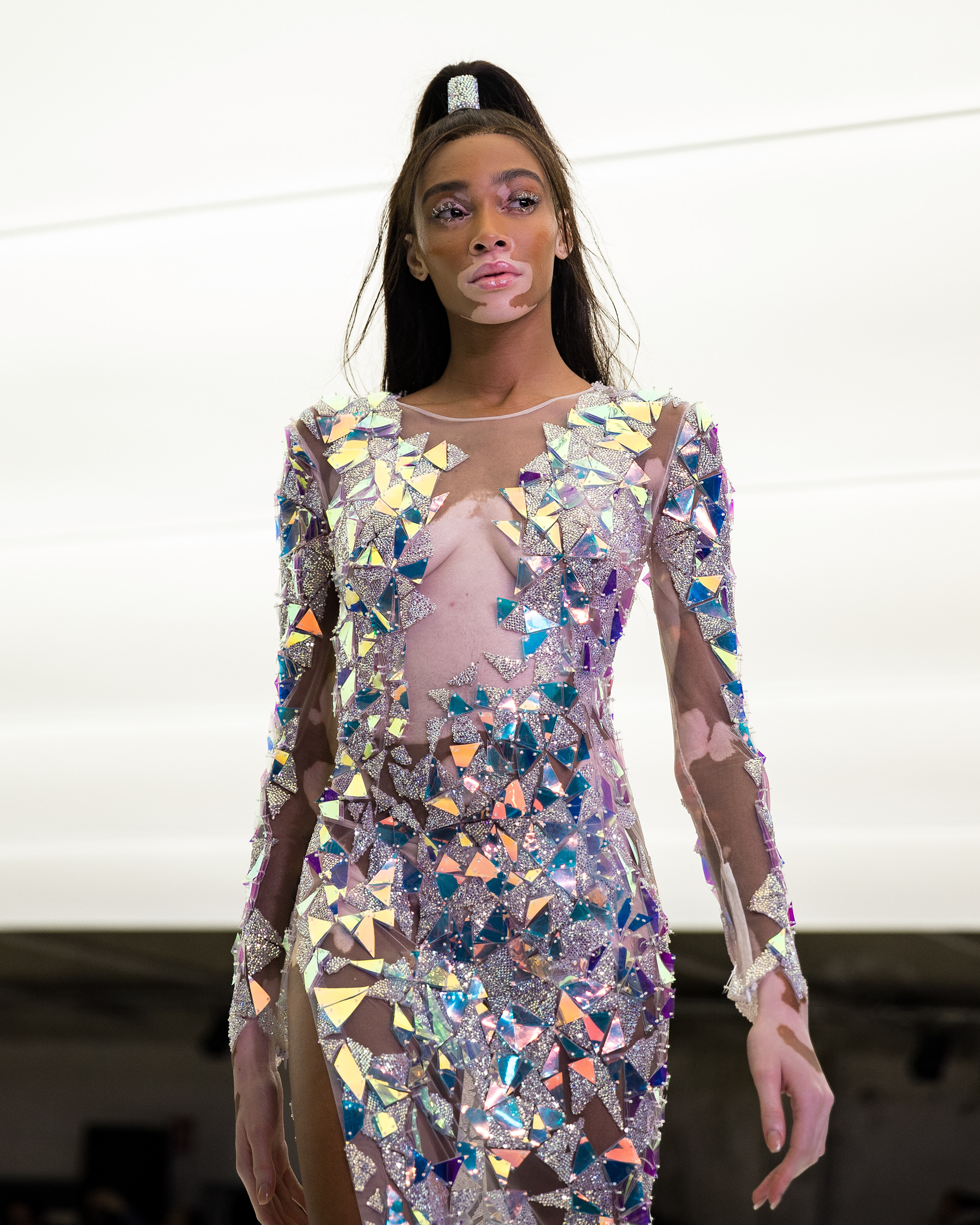 Winnie Harlow