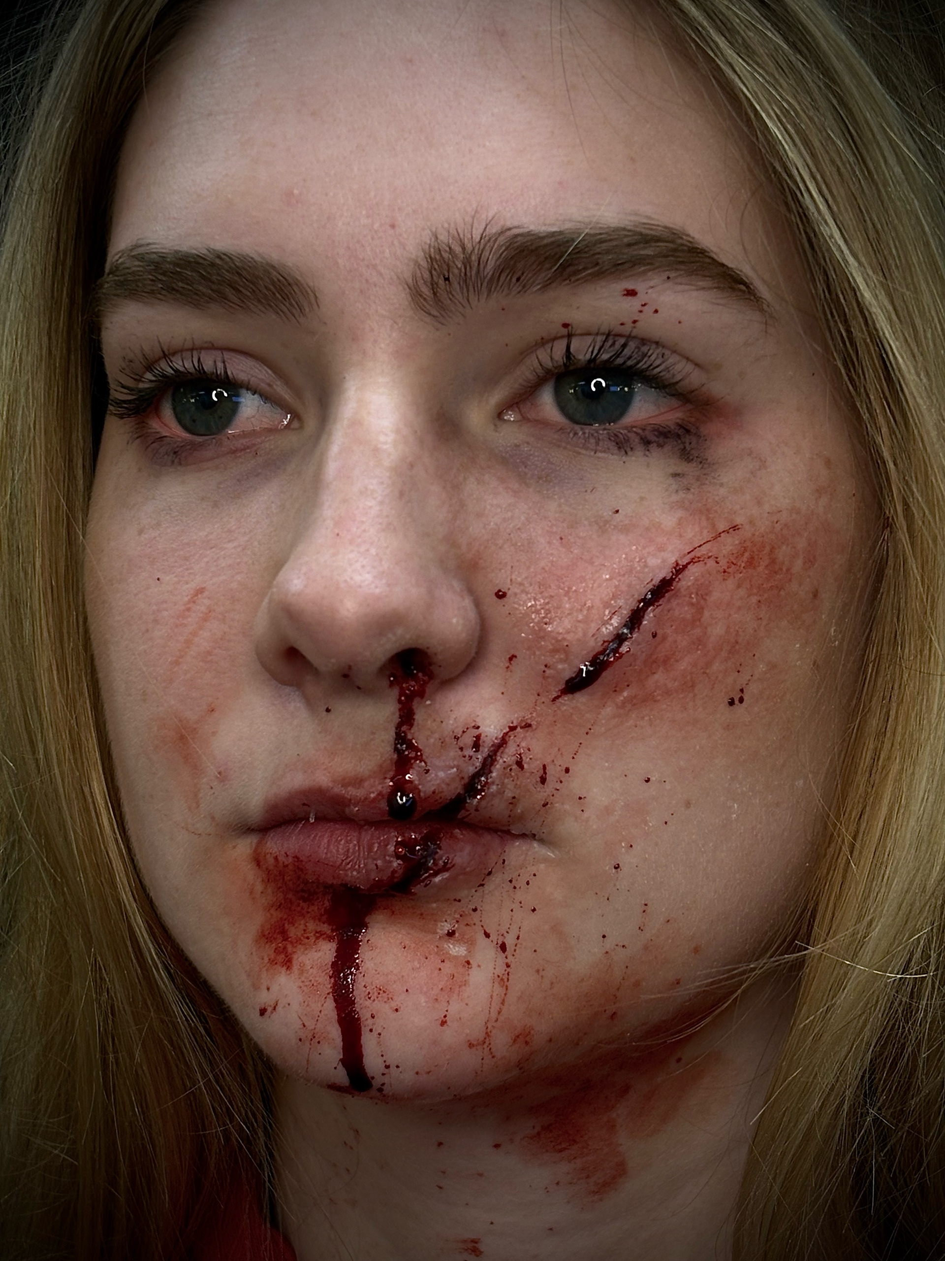 'Smashed Glass Injury' 2025