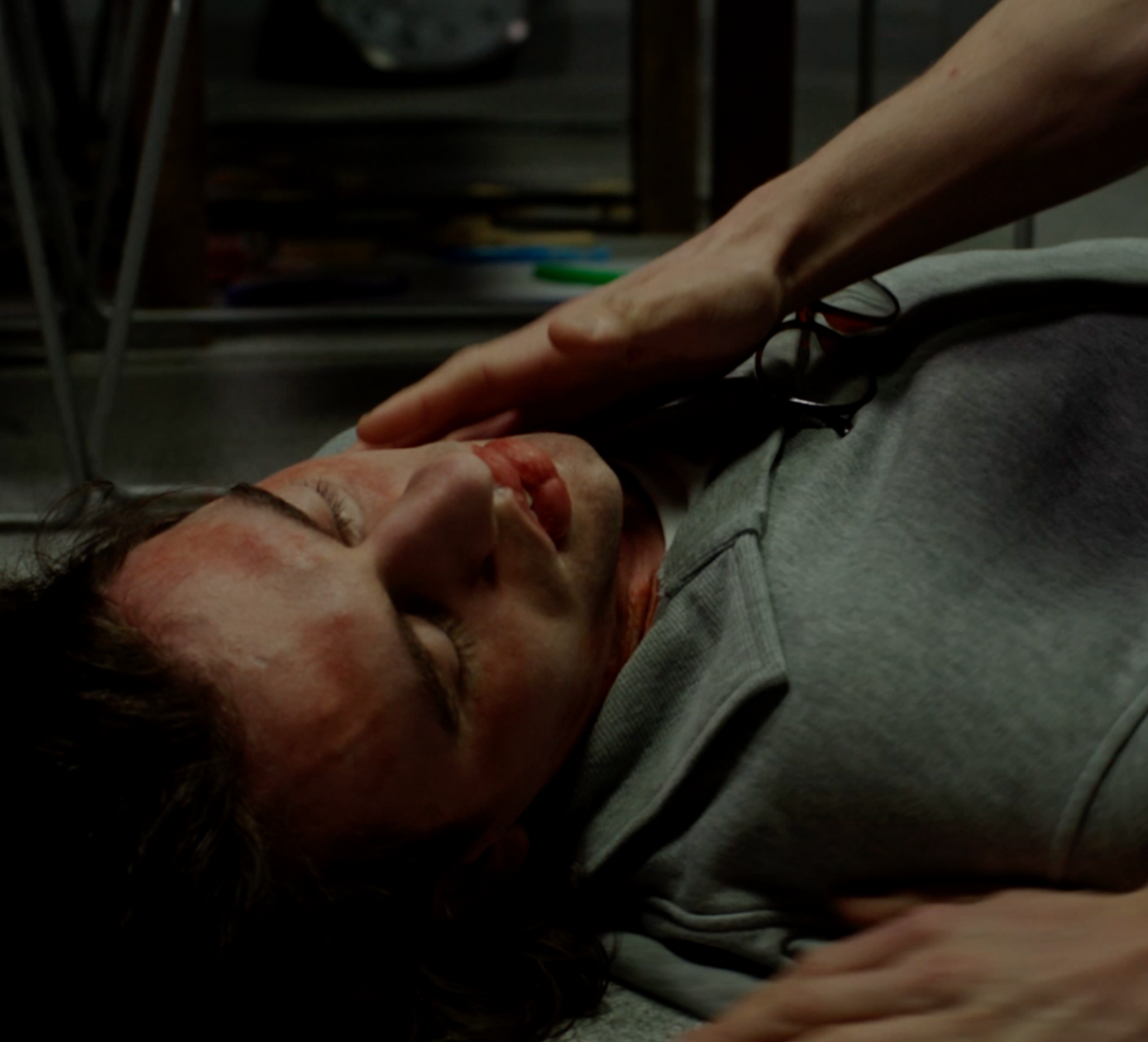 'Anaphylaxis Stage 4' Still