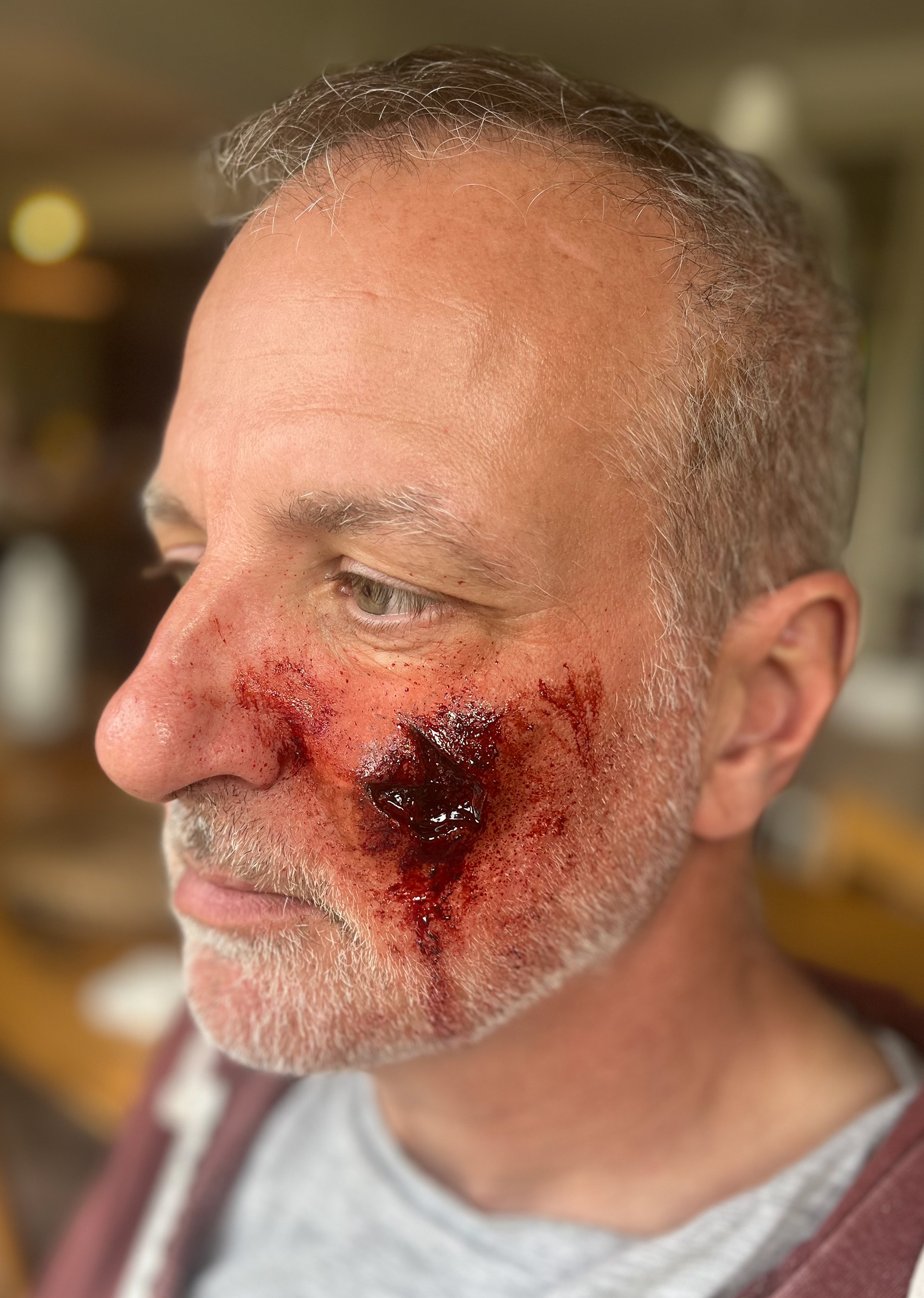 'Aged Bullet Exit Wound'