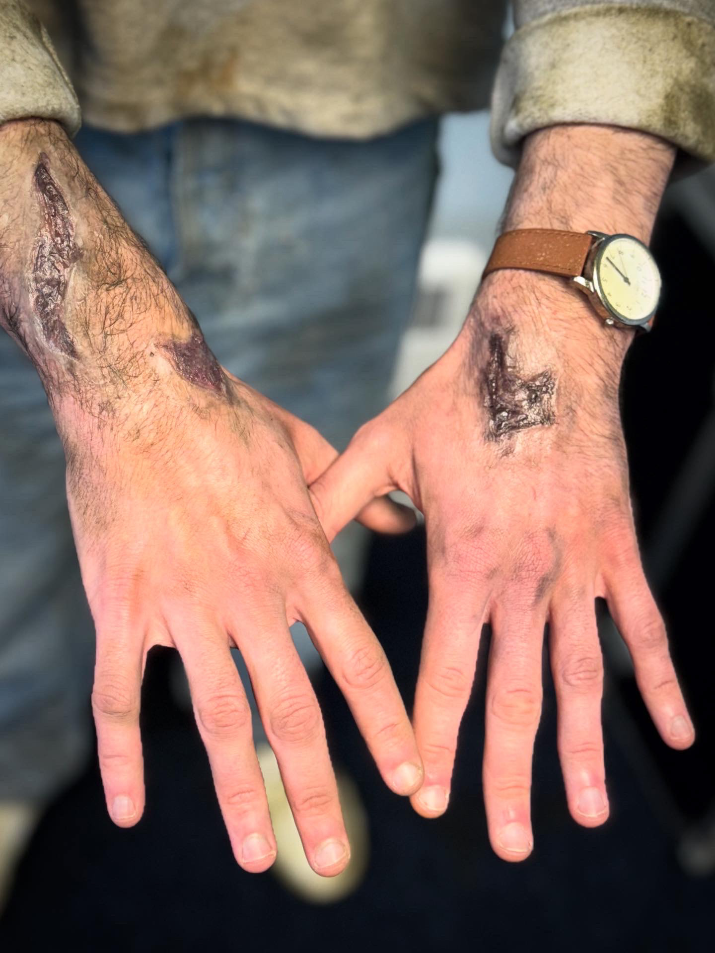 'Surrealist Decay Hands'