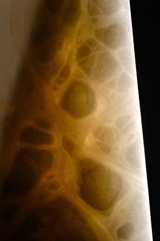 Contained detail