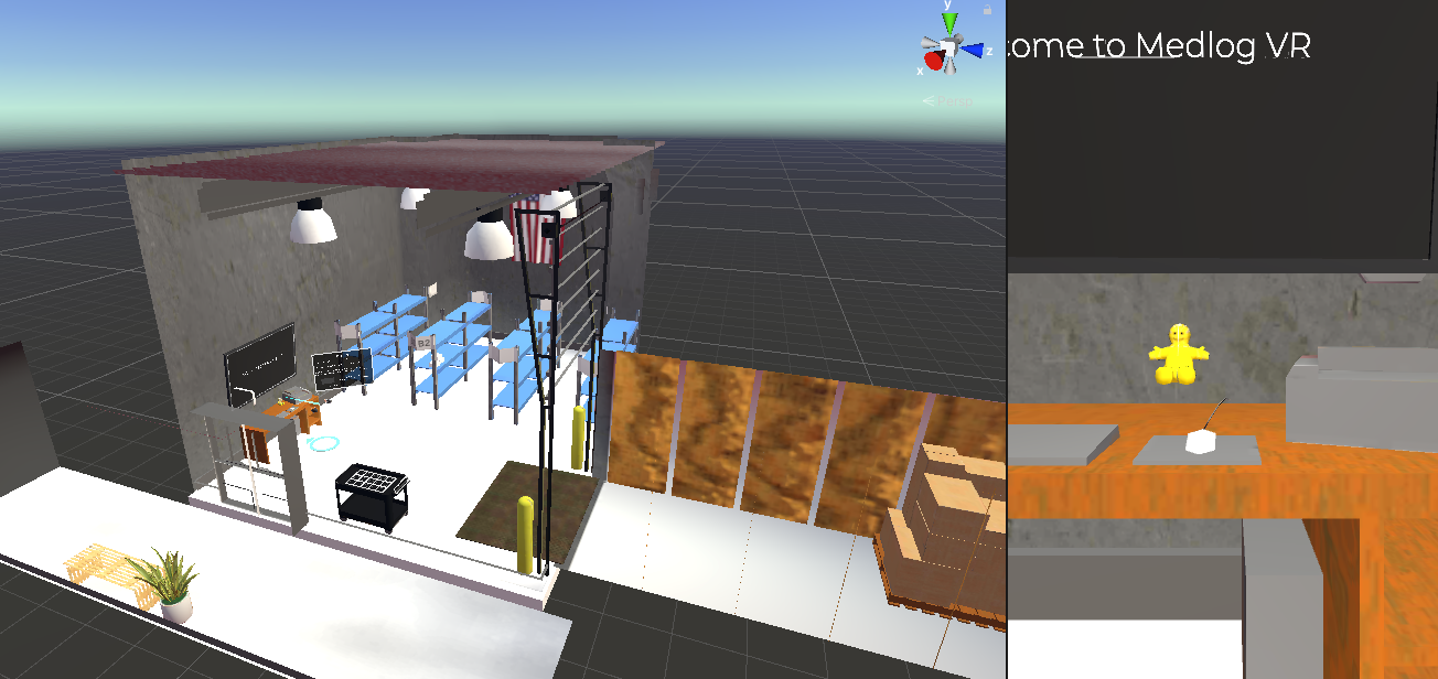 V1 set up in Unity