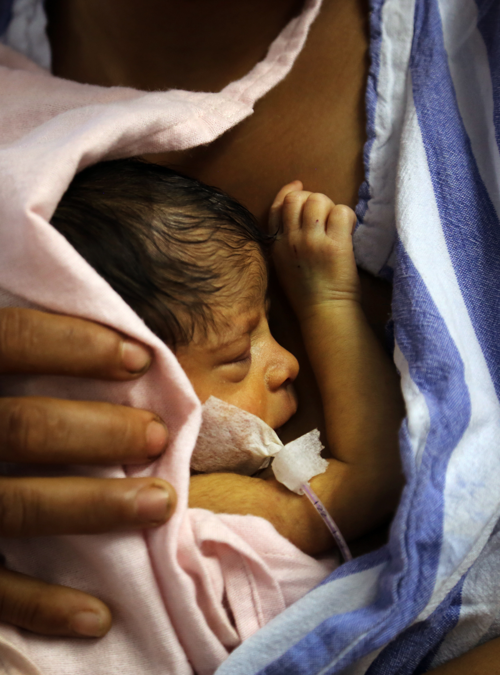 In Raipur district hospital,  premature baby in kangaroo pouch at the neo-natal unit of the District hospital. Raipur, India, 2015