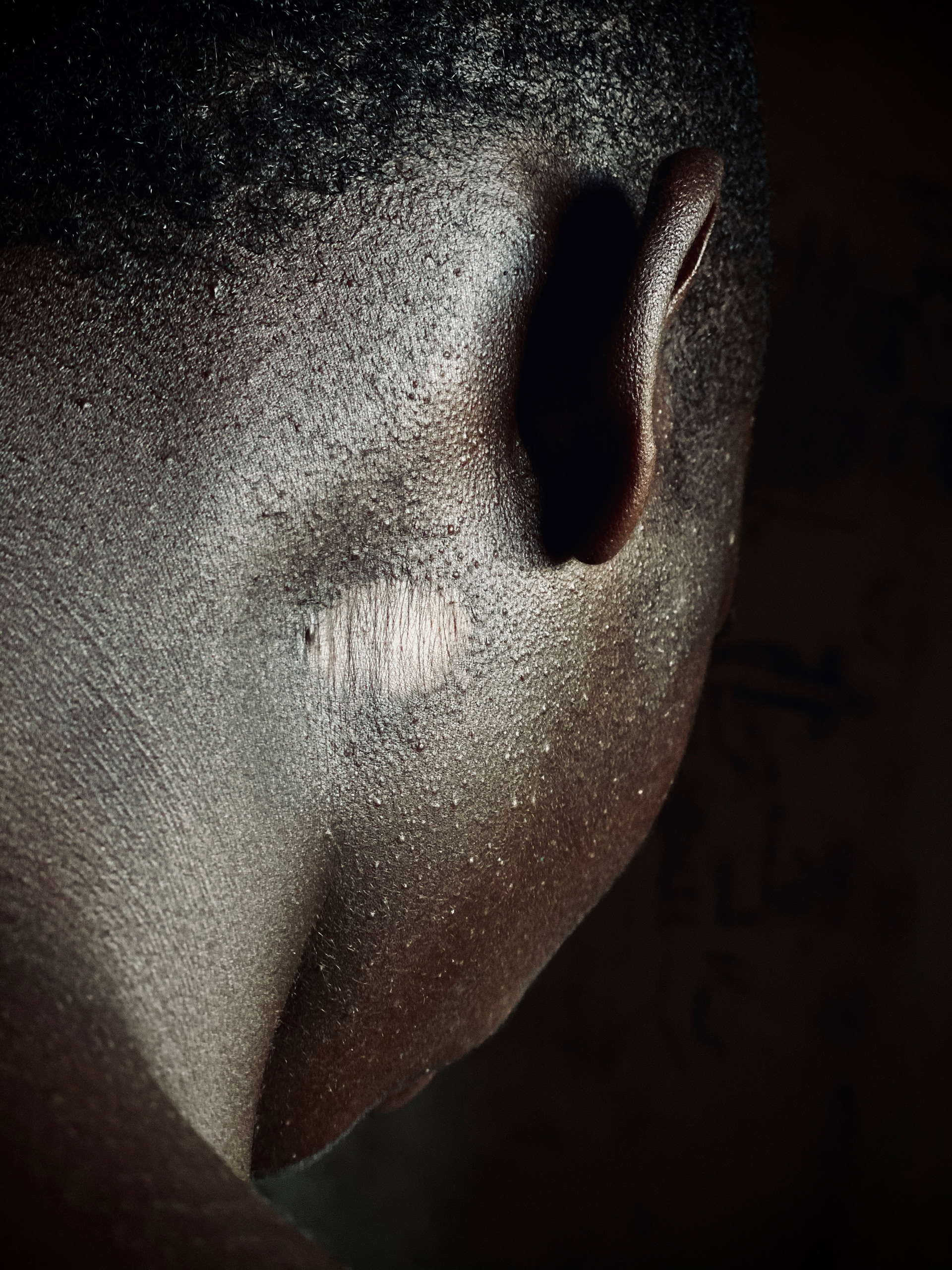 A youth shows a scar from a bullet wound on his neck  at the Centre de transit et Orientation CAJED in Goma. 