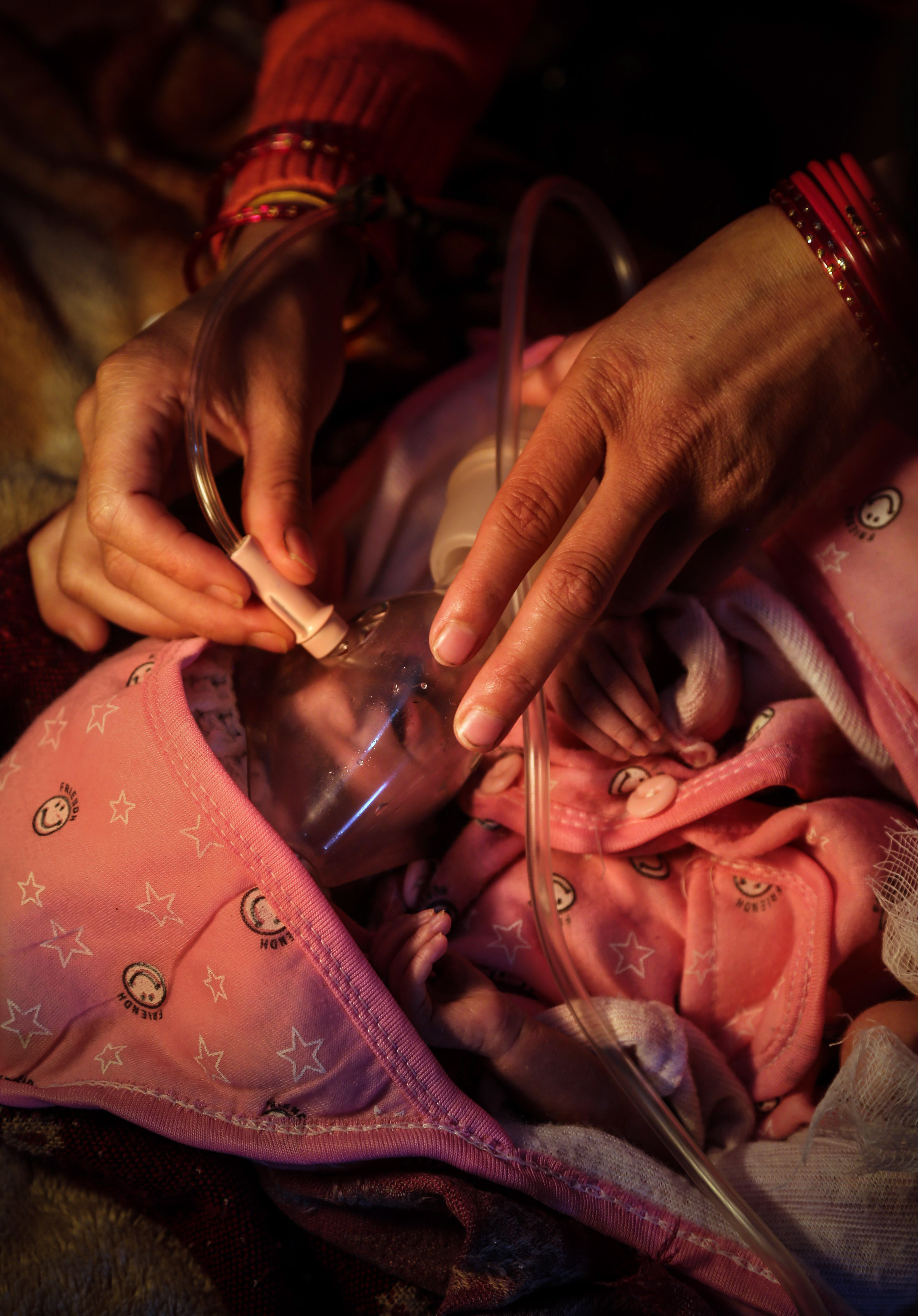 A premature baby receives oxygen in a neo-natal care unit in Western Nepal, March 2015