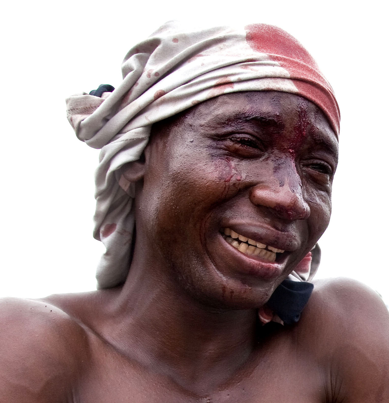 Man rescued from a lynch mob, Central African Republic