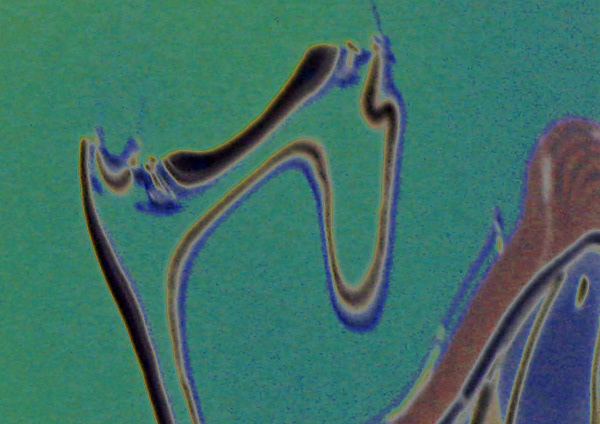 loss of perspective 10