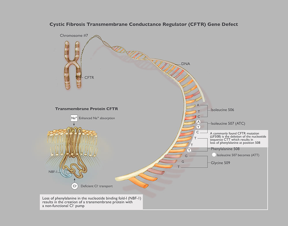 "CFTR Gene Defect" Photoshop