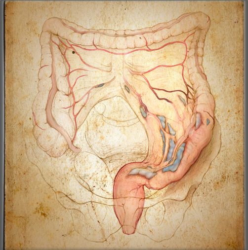 "Colon Cancer" Photoshop