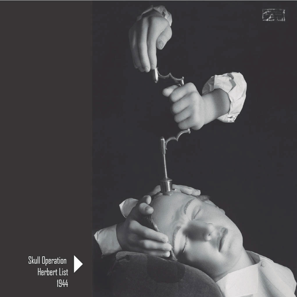 Skull Operation