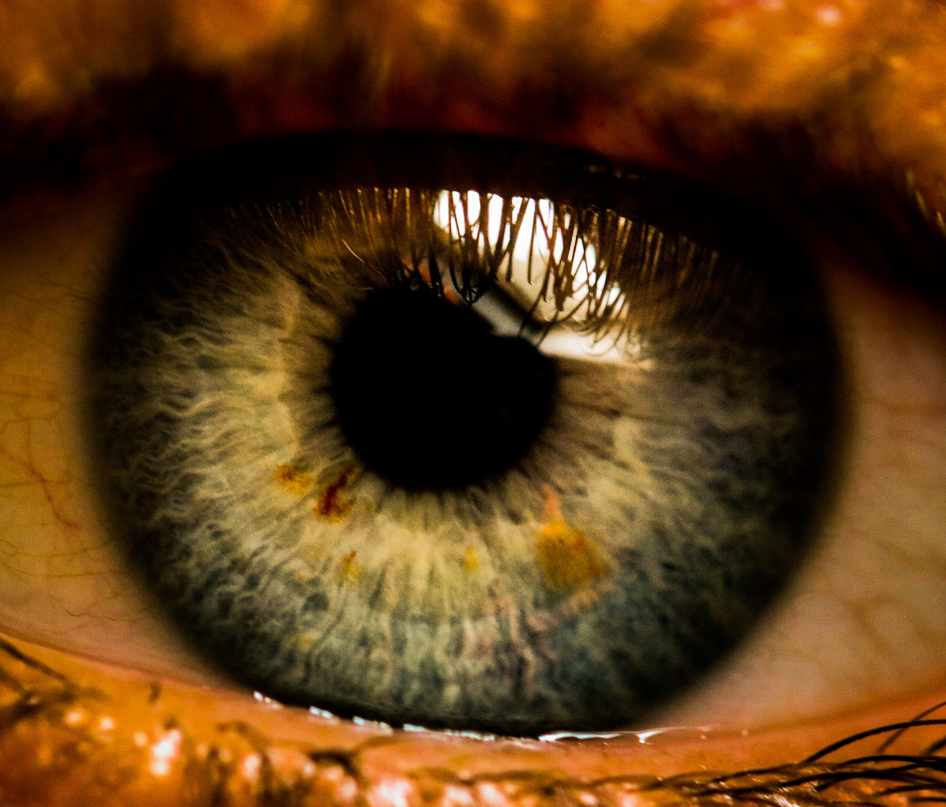 Eye
