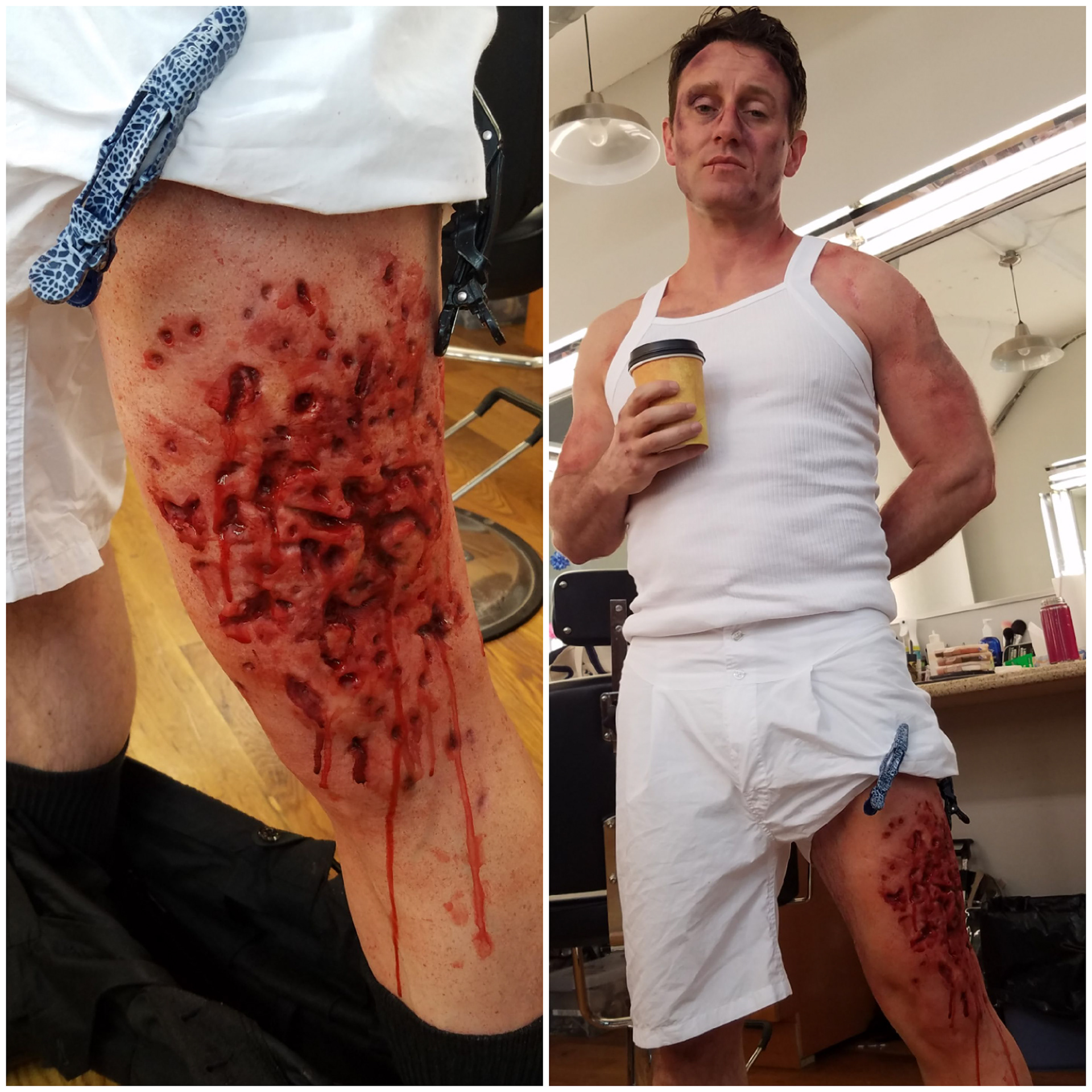 "Pilgrim" shotgun blast to the leg. The Punisher S2