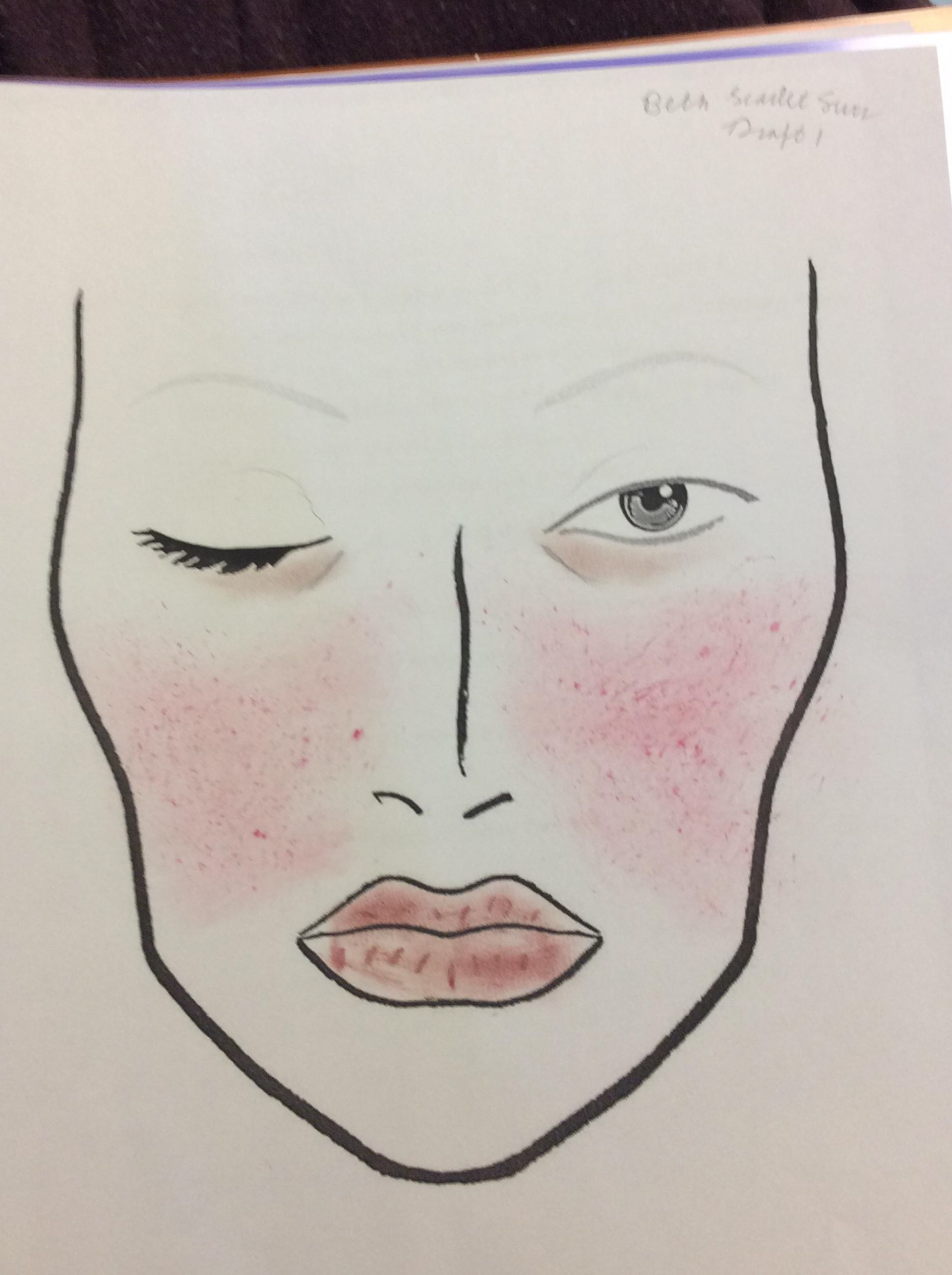 Beth March as Scarlet Fever takes its toll