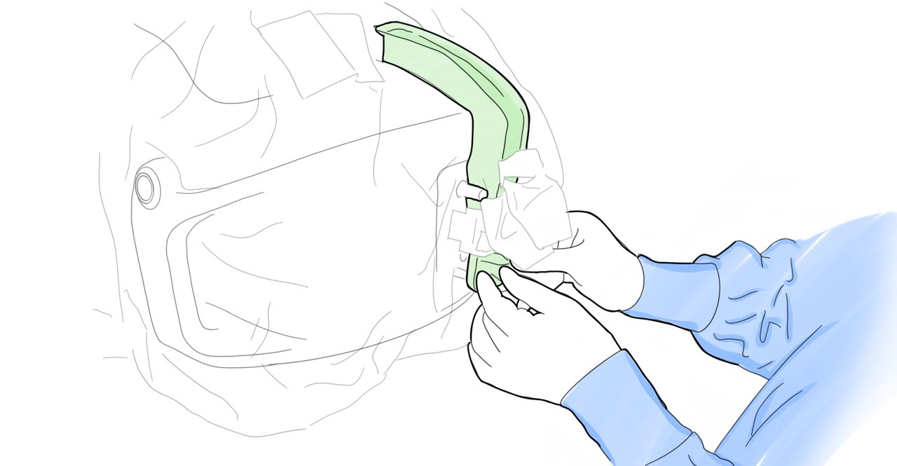 Install endoscope sleeve 