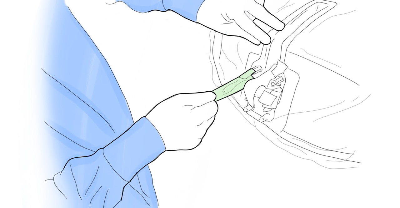 Remove roller and mount post covers