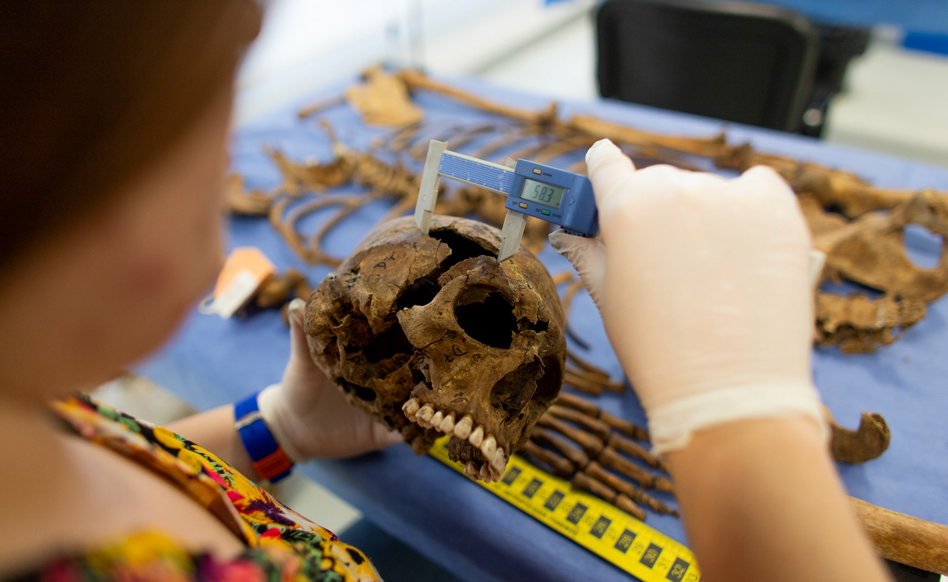 Gala Maruscak member of the Argentine Anthropology Forensic team’s Laboratory examines the skeleton of an unidentified missing person in the City of Buenos Aires, Argentina.