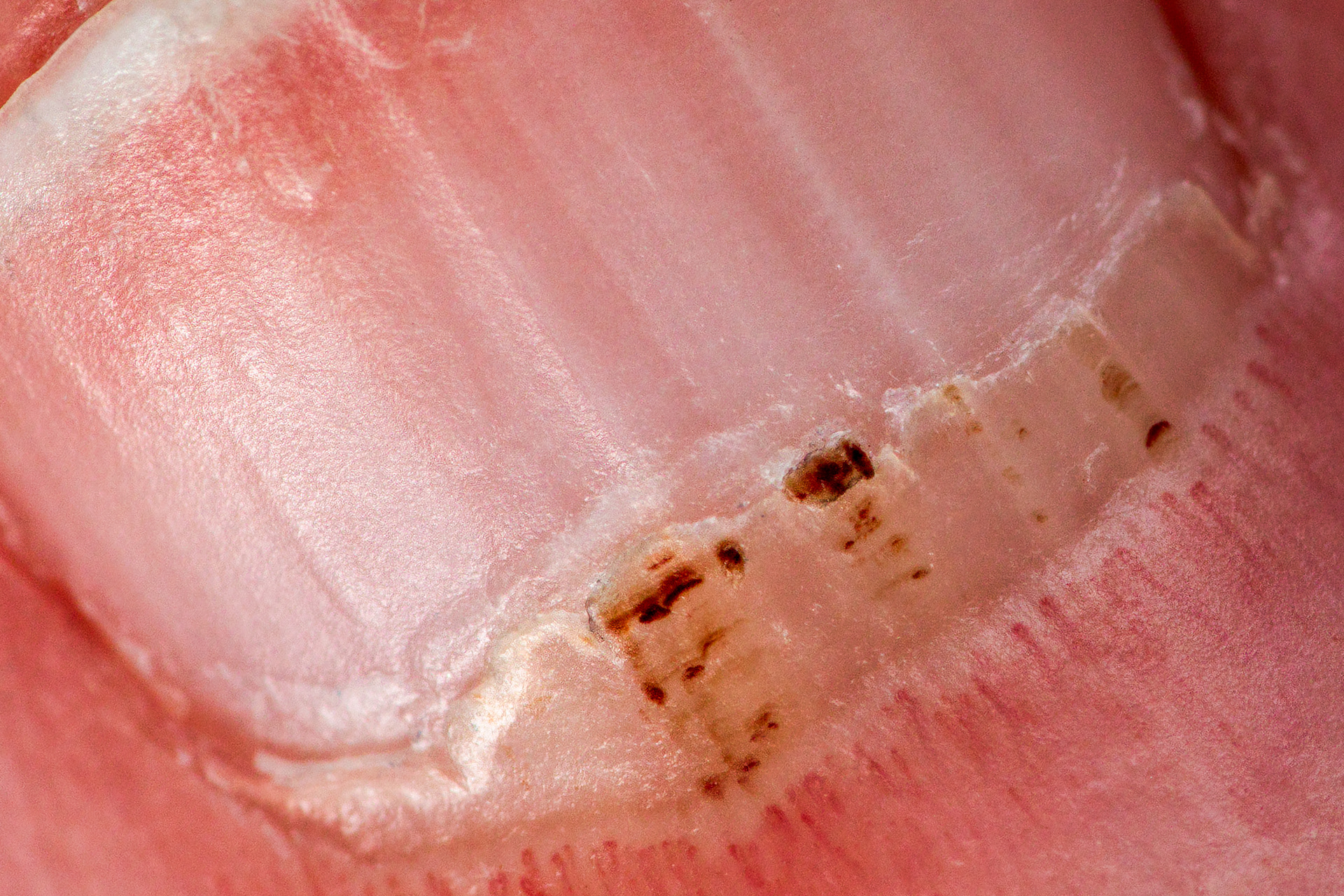 Detail of Nail Bed -- 2024