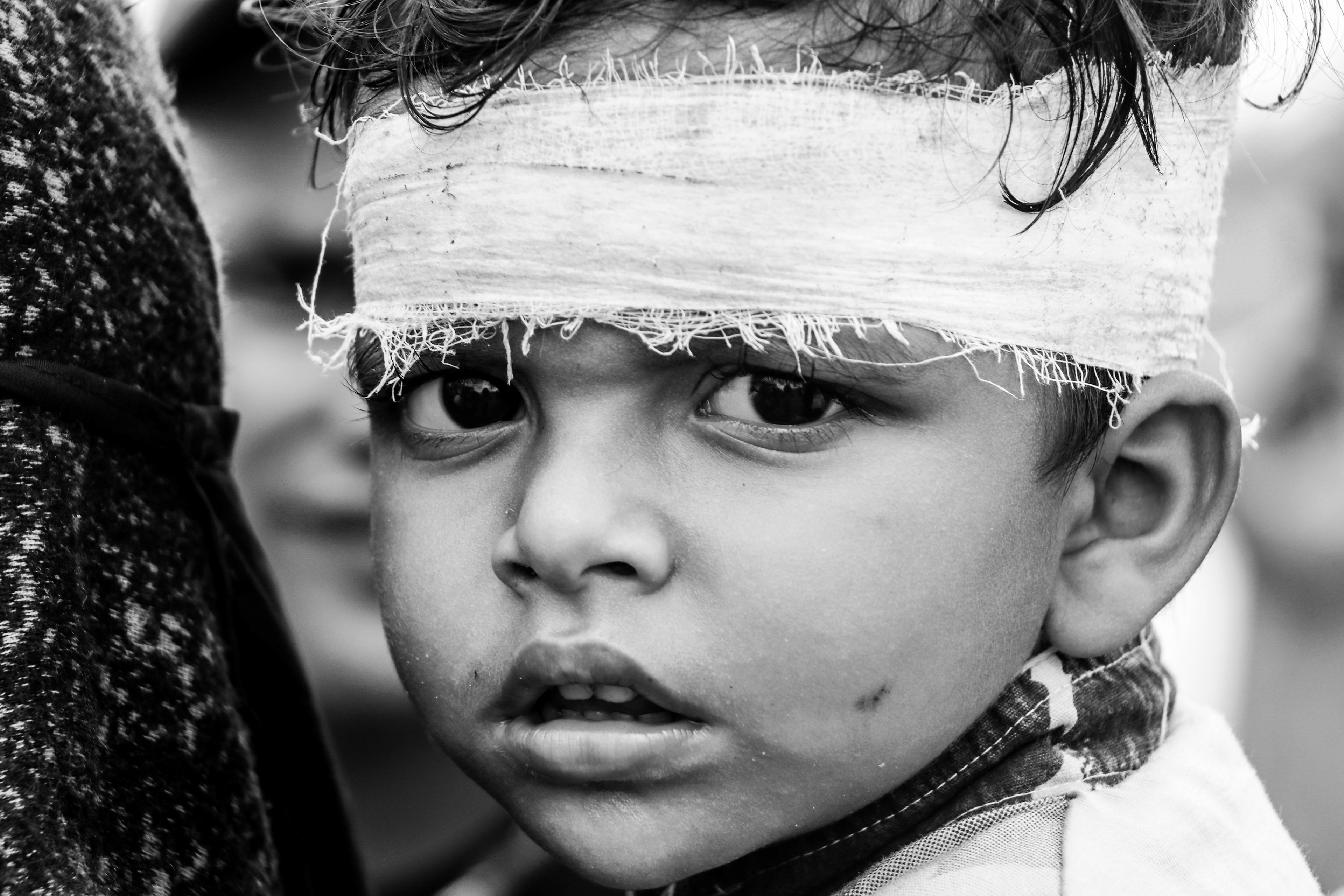 Hurt child