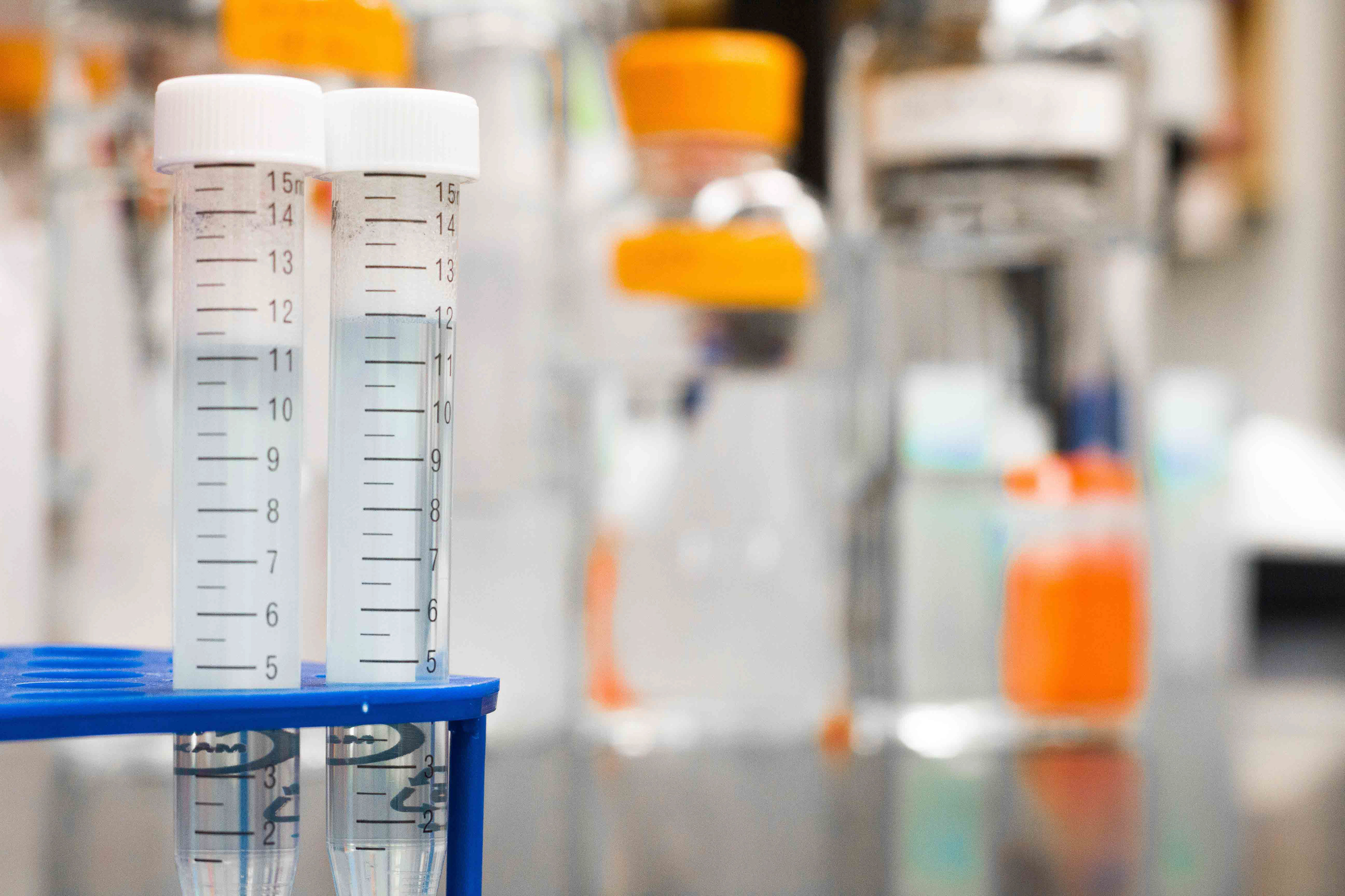 Entnahmerörchen stehen bereit für Labortest