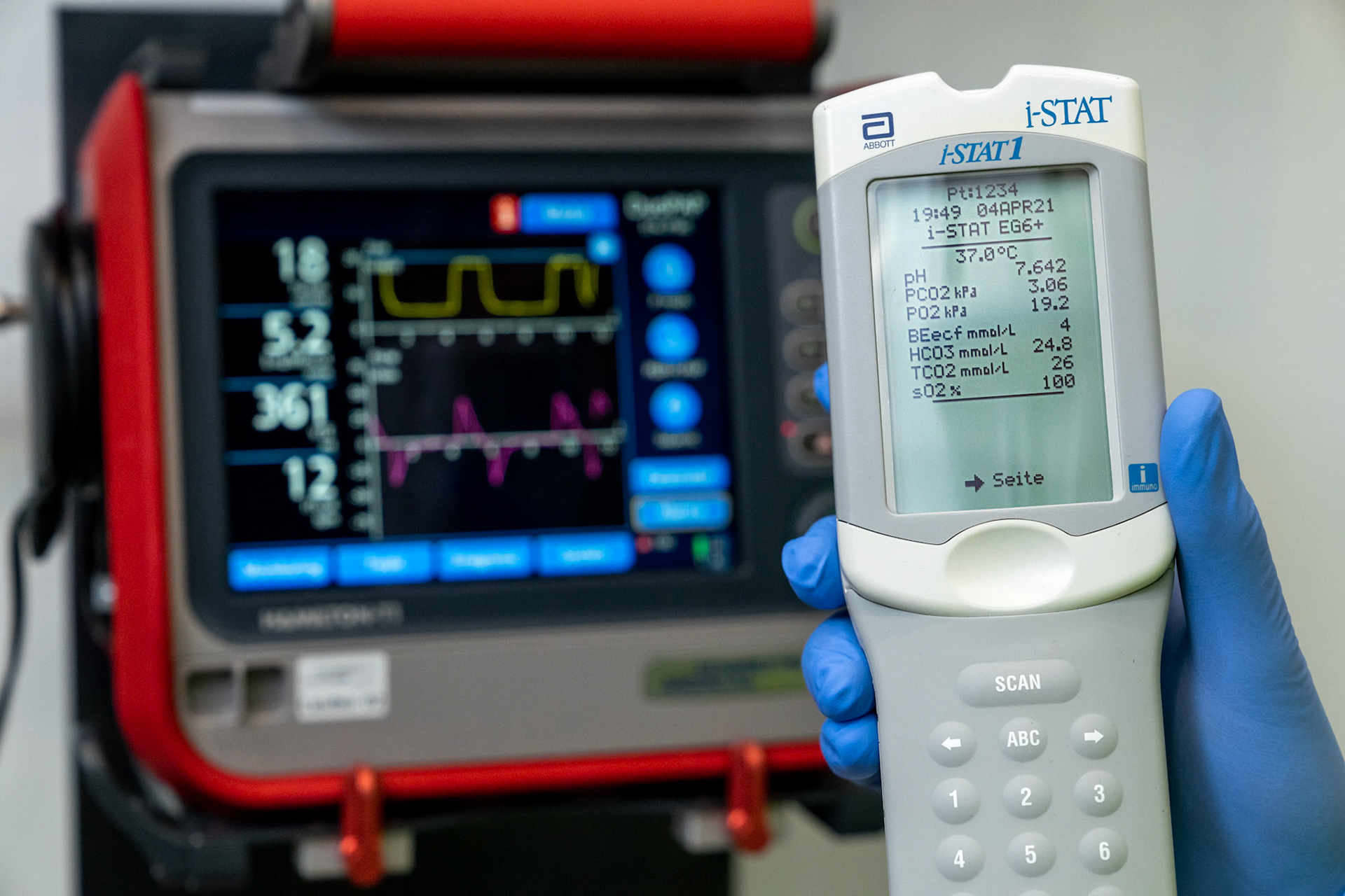Blood gas analyser in front of ventilator