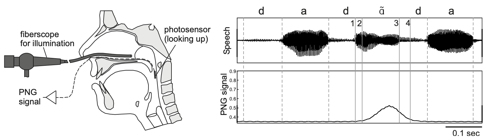 Illustration PNG éclairé par un Fibroscope et données résultantes