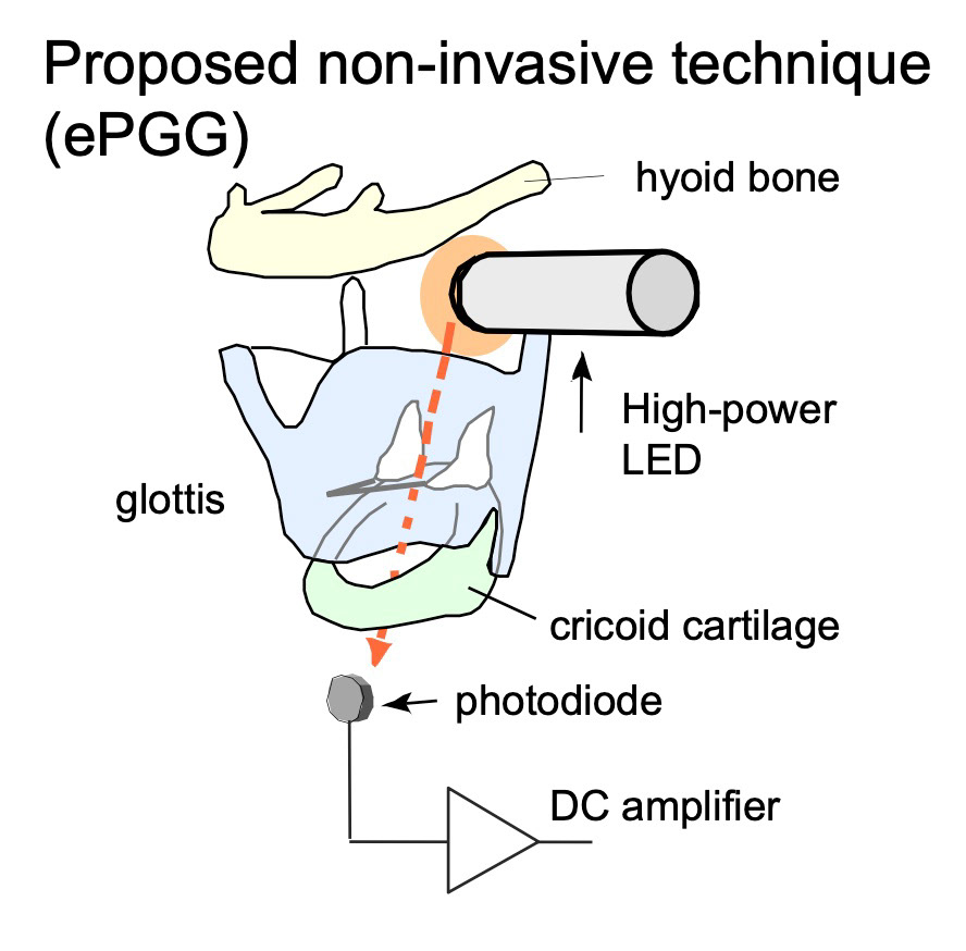 Première version de l'ePGG