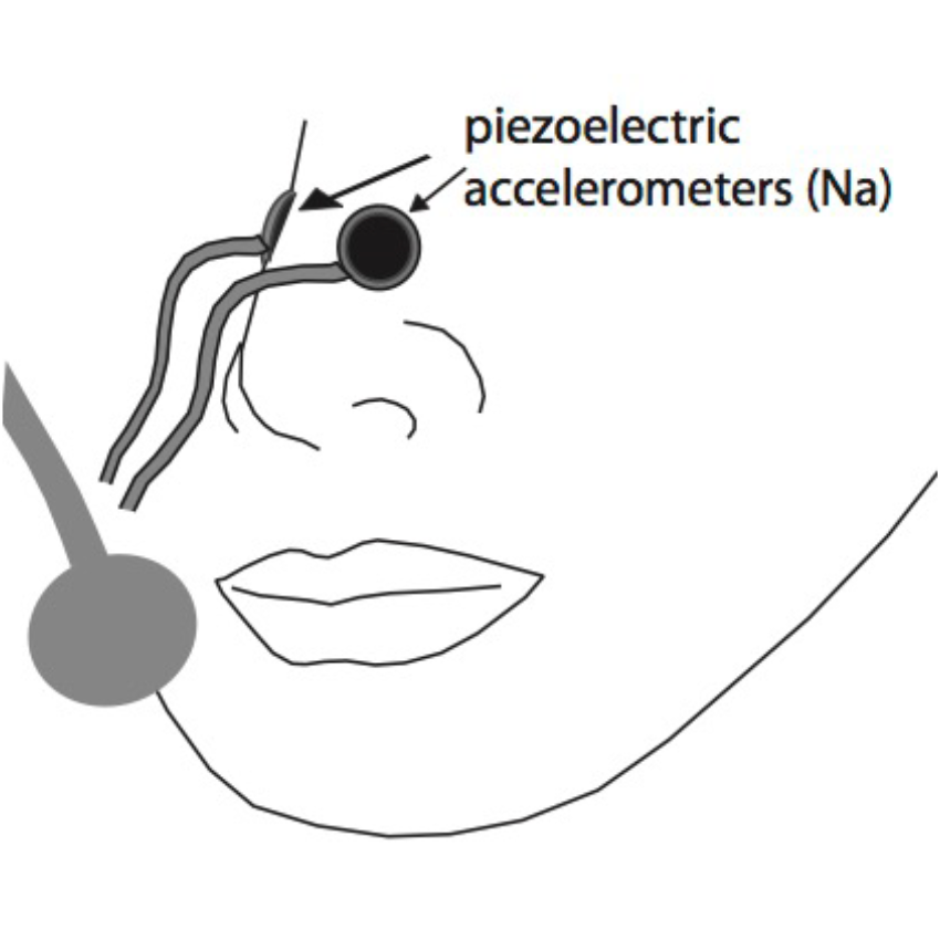 Accéléromètre piézoélectrique