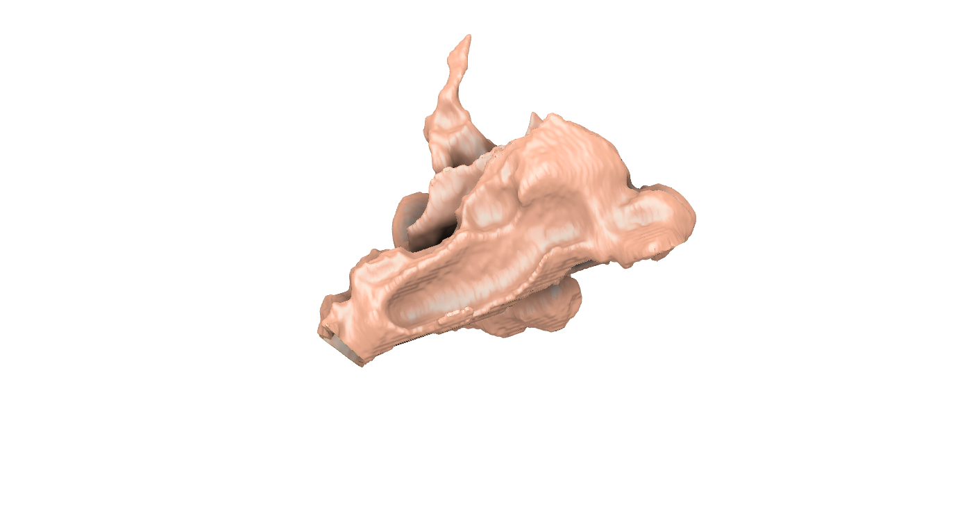 Conduit nasal