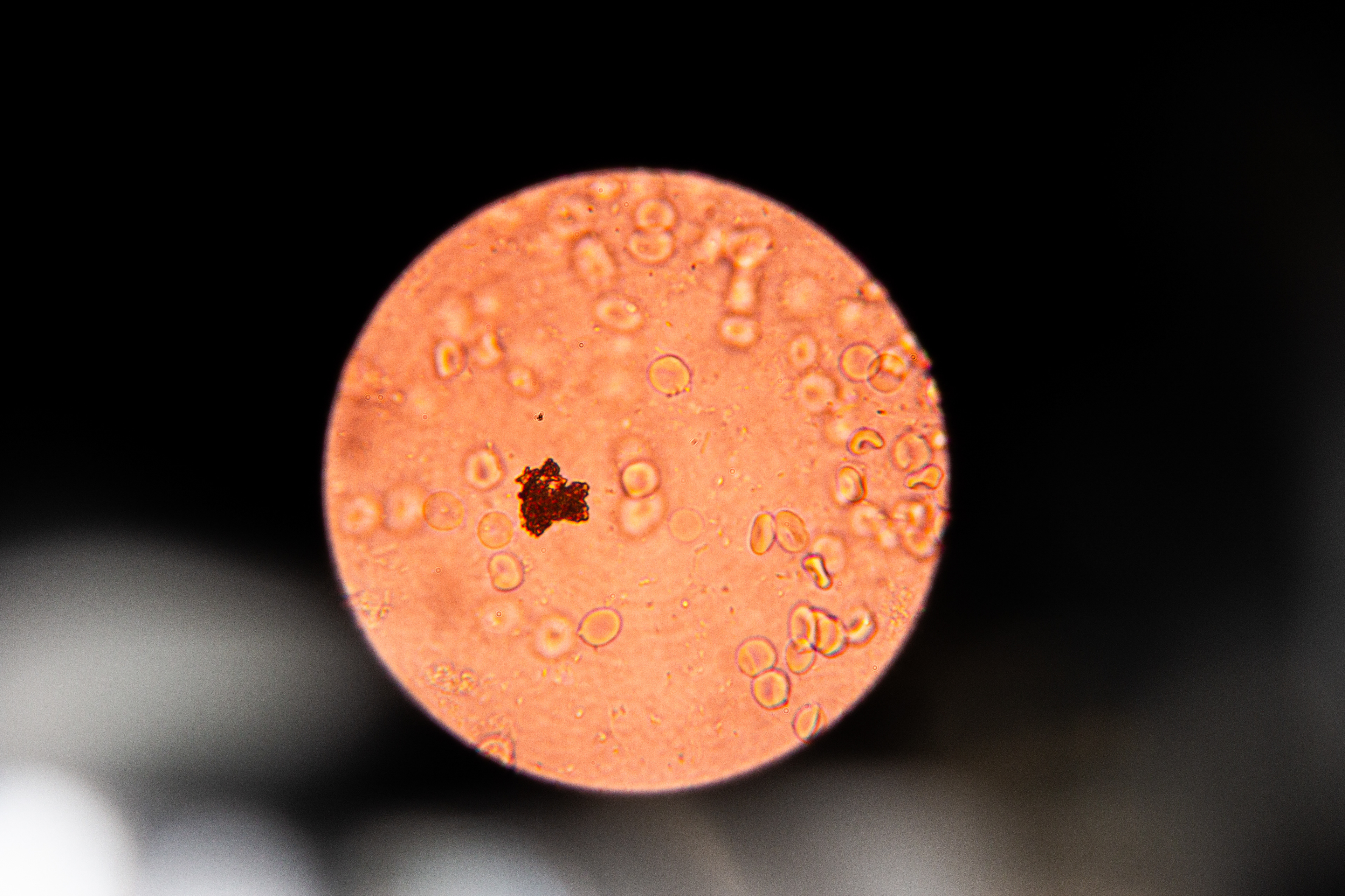 Menstrual Blood 400x