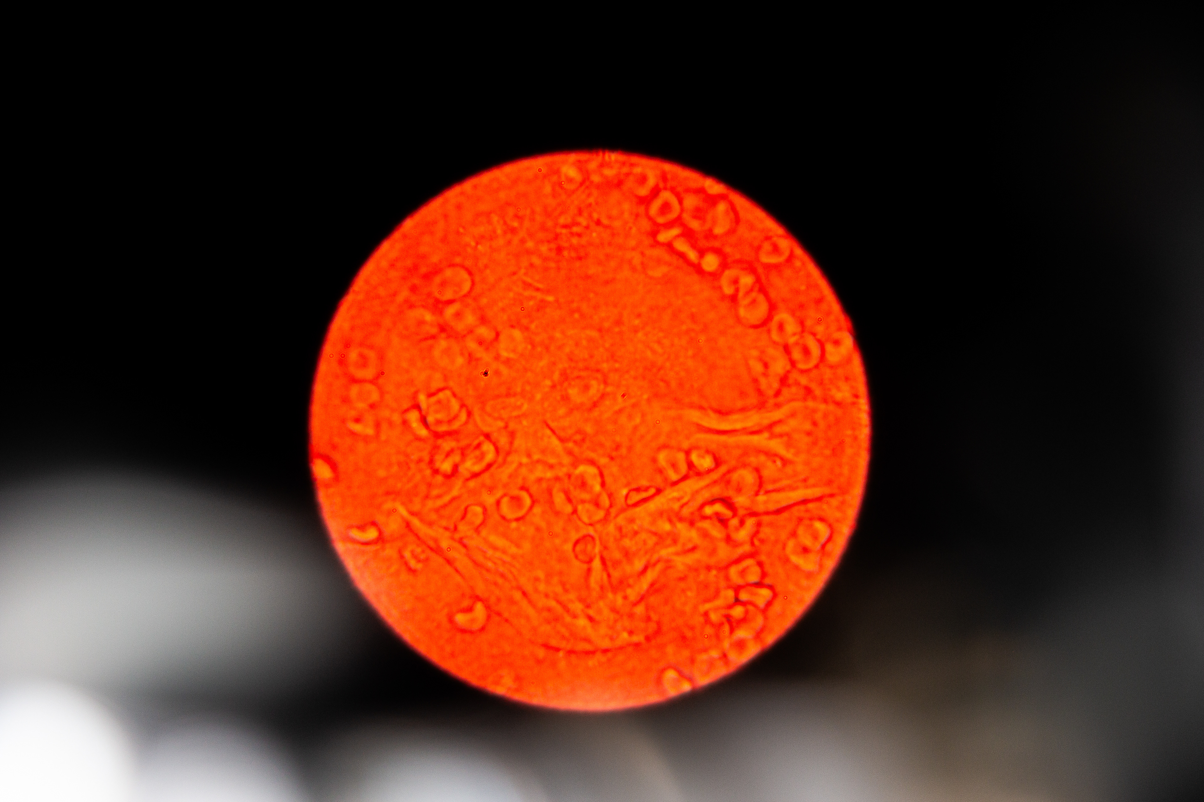 Menstrual Blood 400x