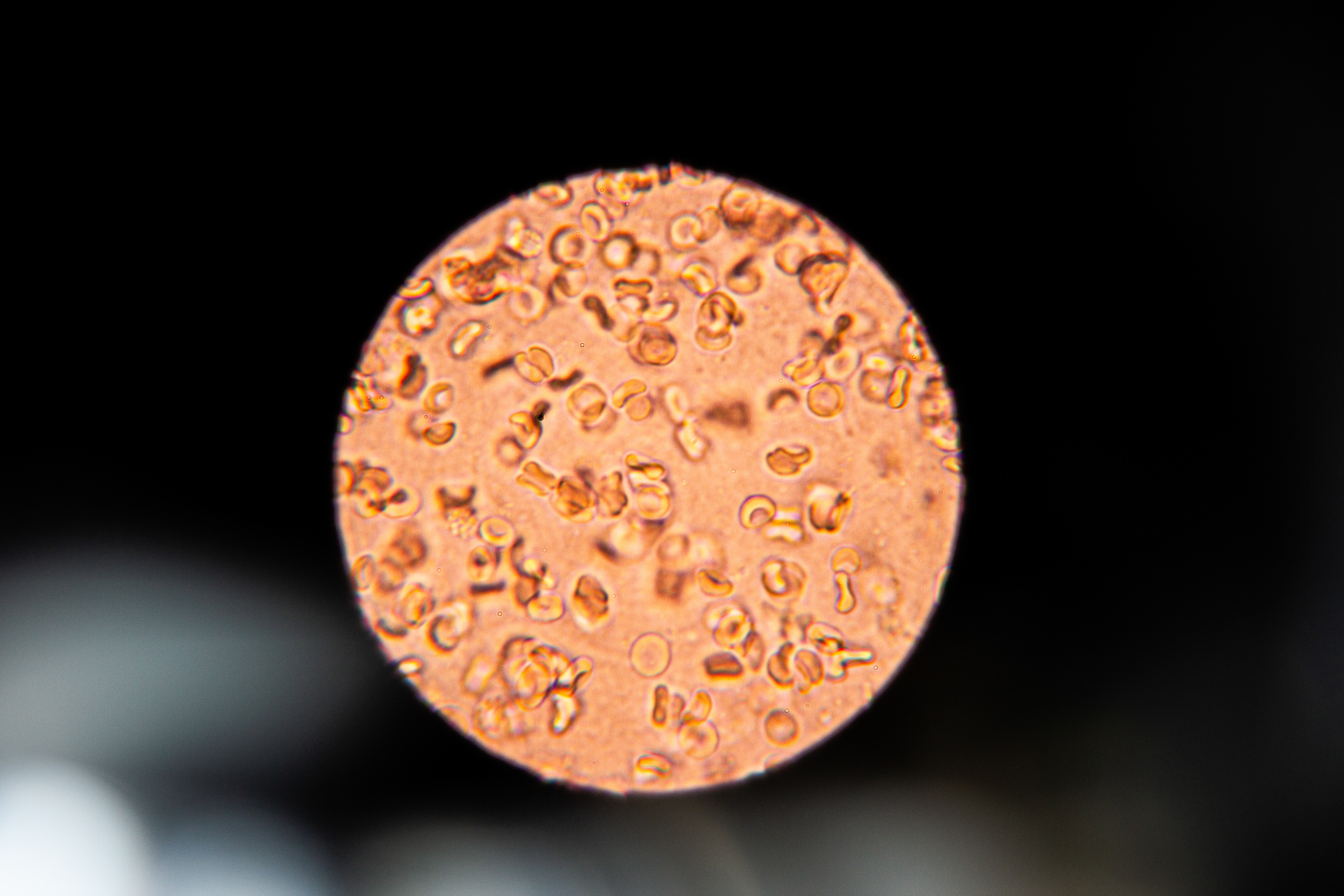 Menstrual Blood 400x