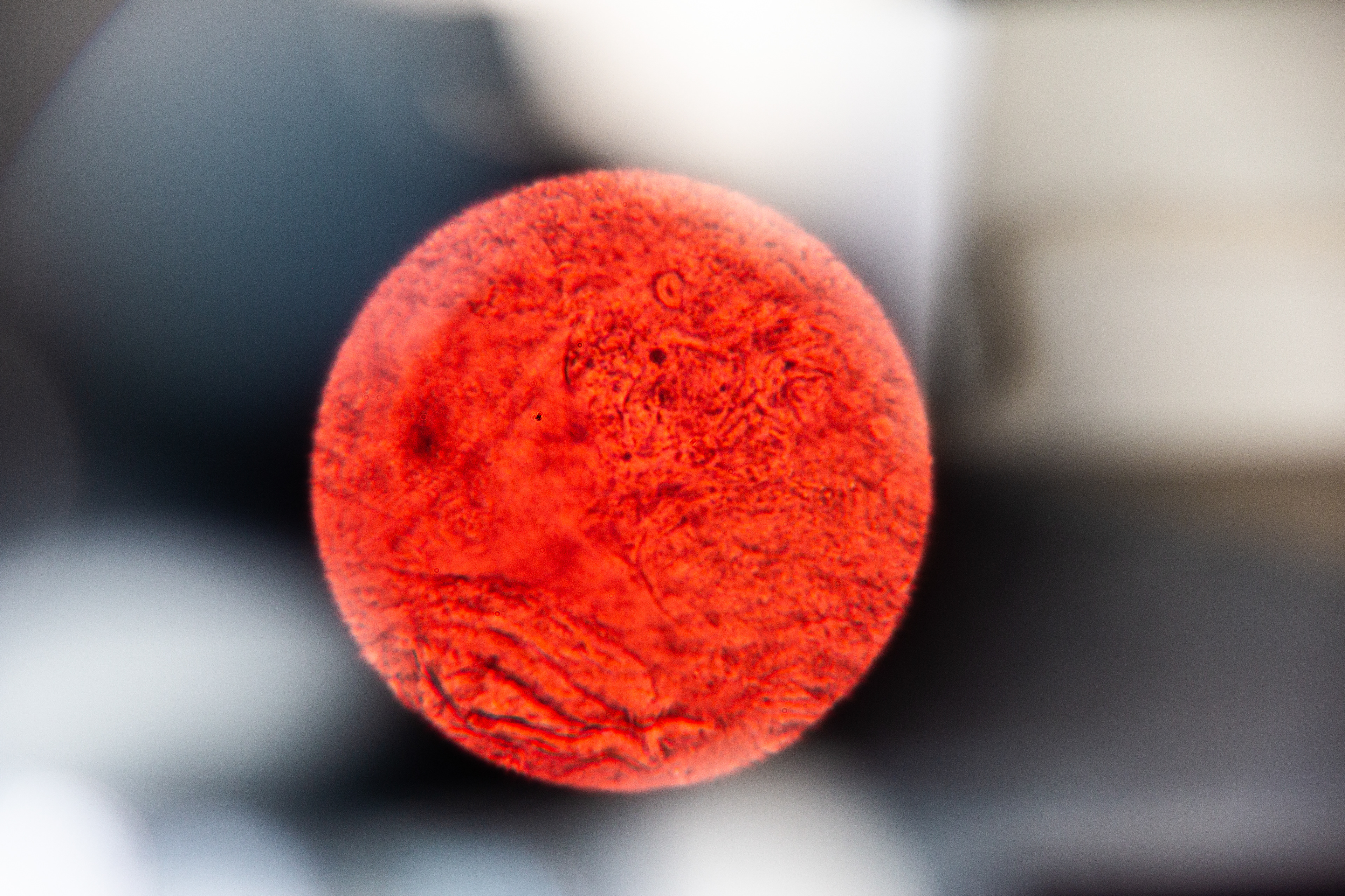 Menstrual Blood 400x