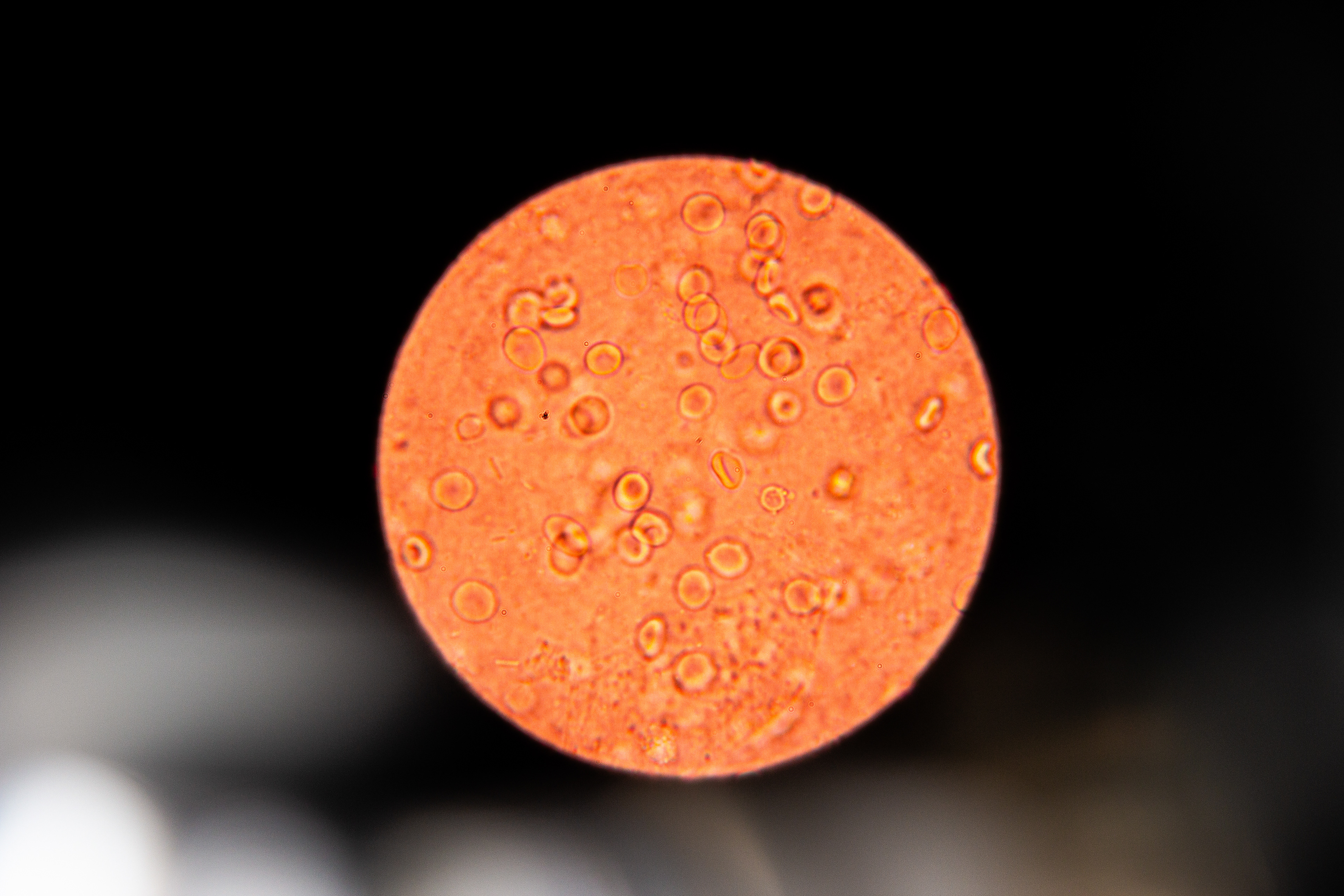 Menstrual Blood 400x