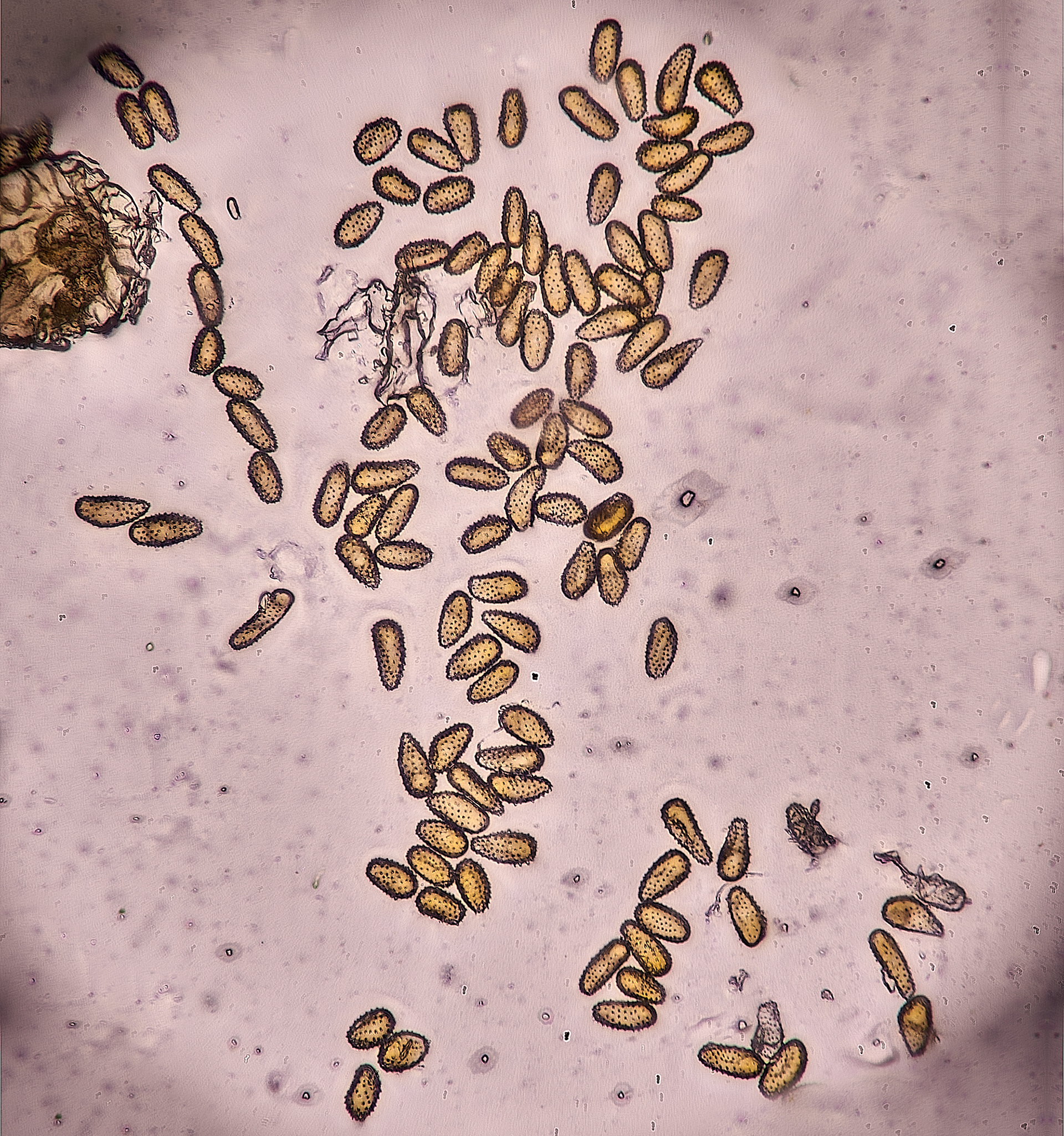 Alder Rust (Melsporidium hiratsukanum)? Urideospores