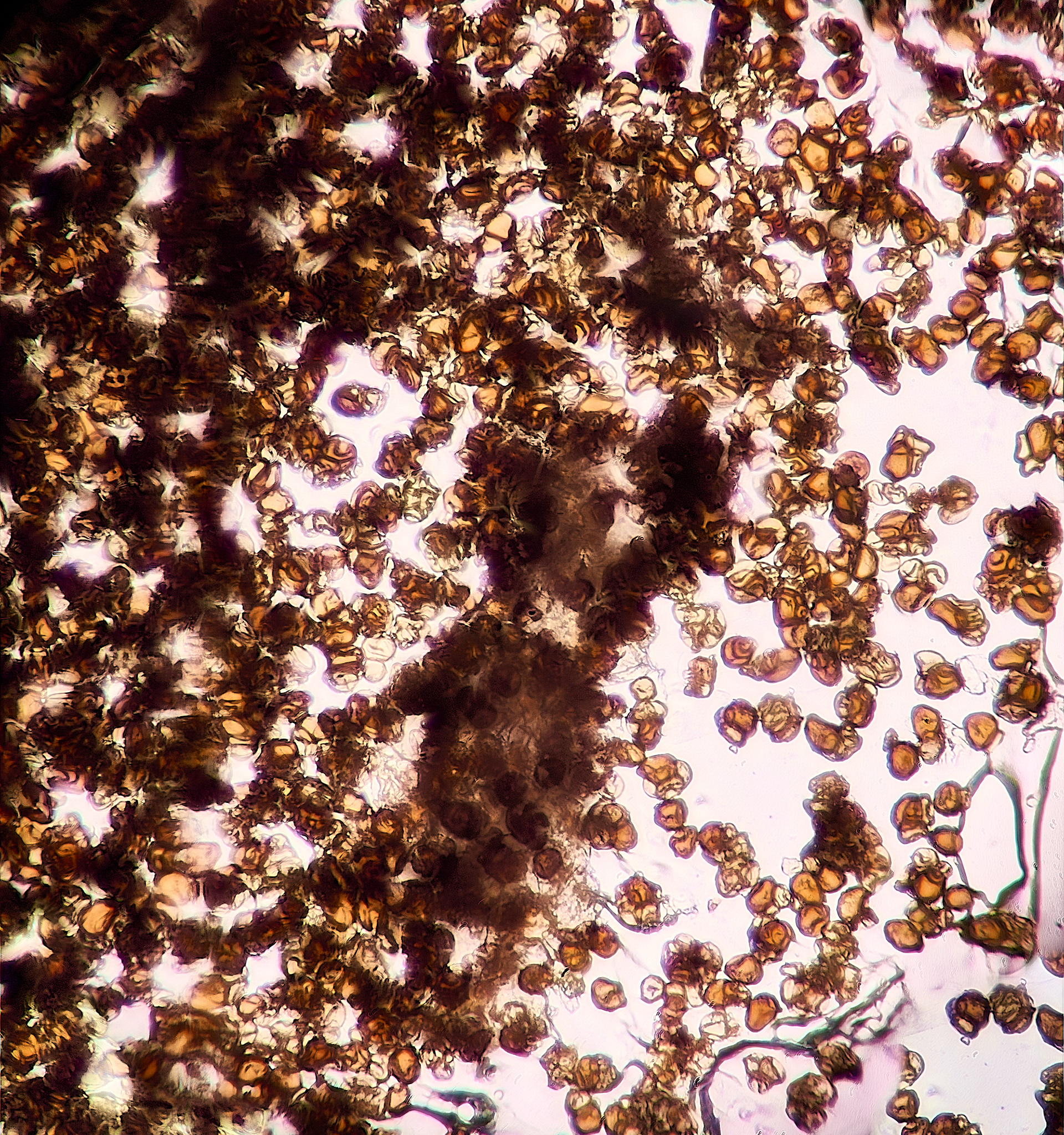 Rust on Creeping Buttercup (Urocystis ranunculi) x200