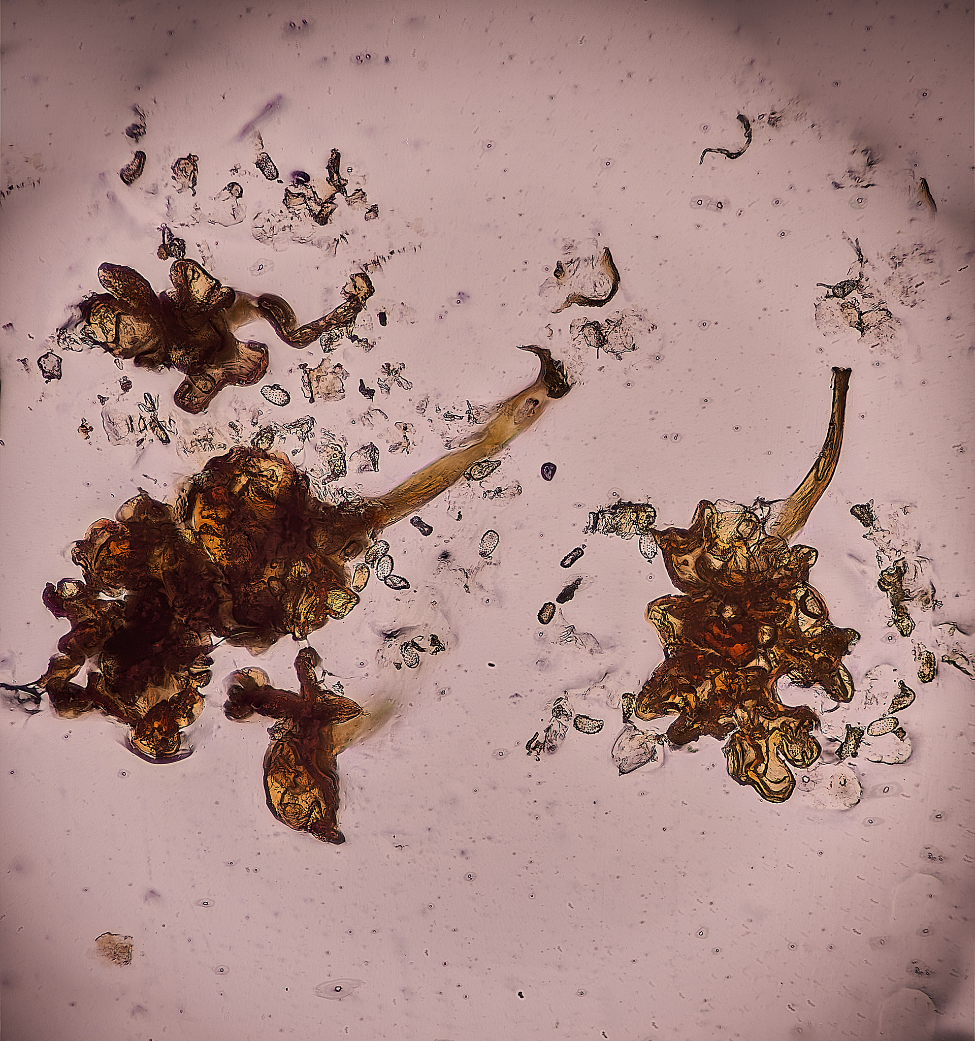 Alder Rust (Melsporidium hiratsukanum)? Uridia
