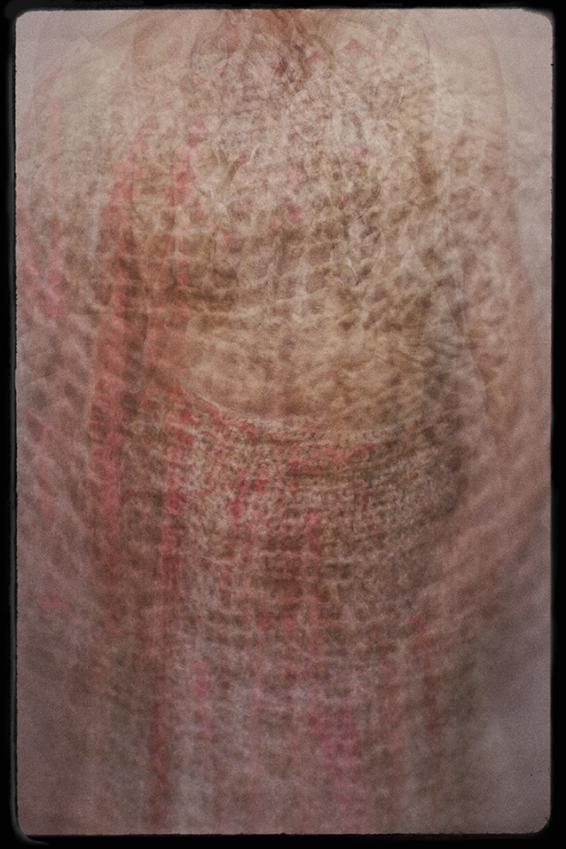 Knotted Dress