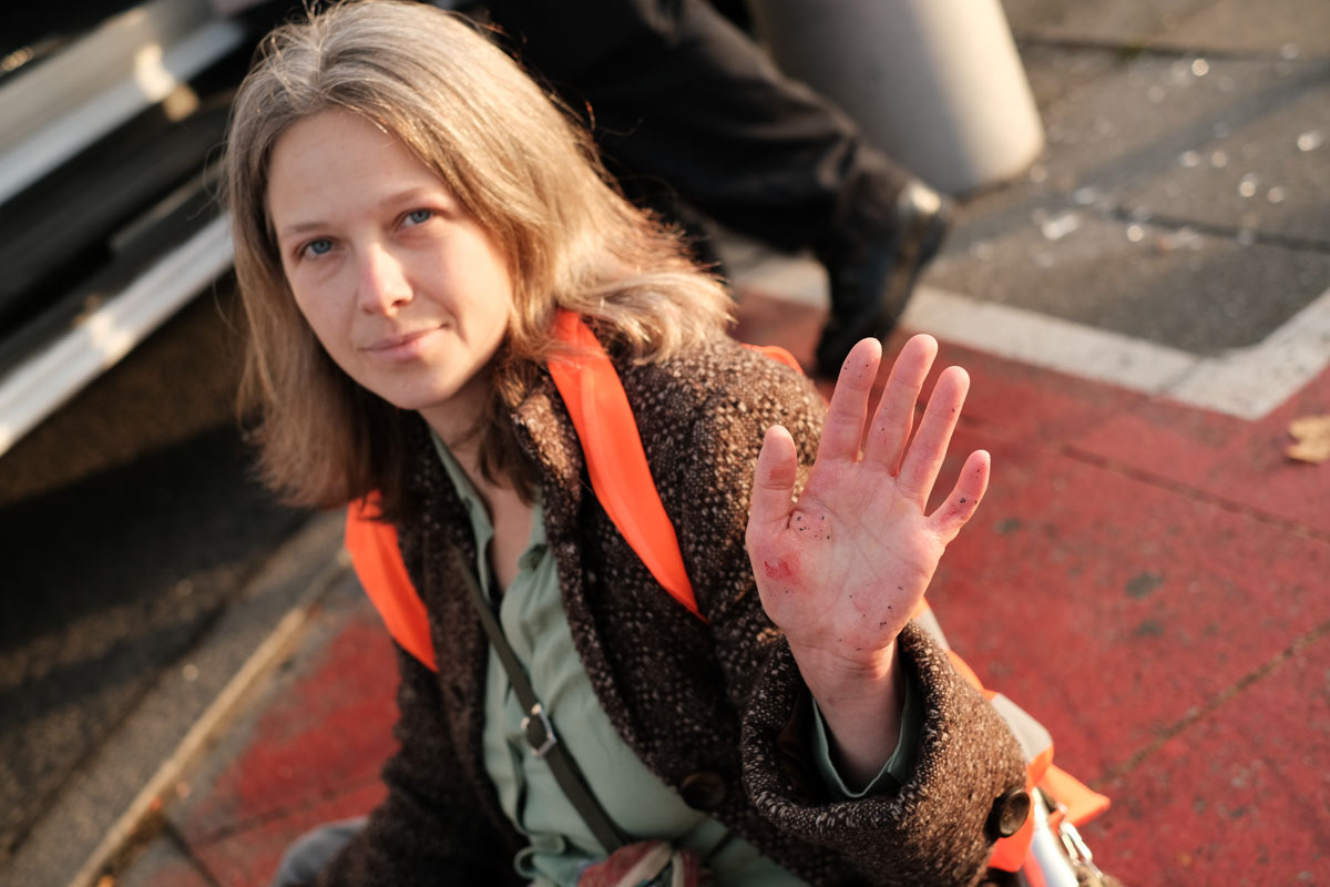 An activist shows her injured hand
