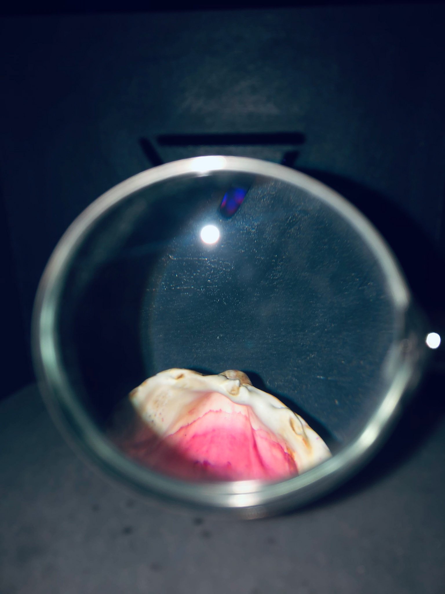 Day 25