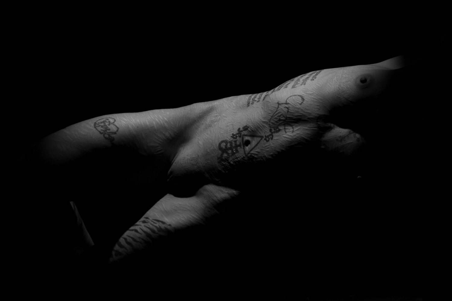 @SolitudeSkinnyScars